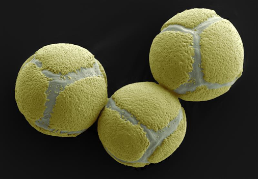 Pollen from wild mahonia flowers imaged by scanning electron microscope