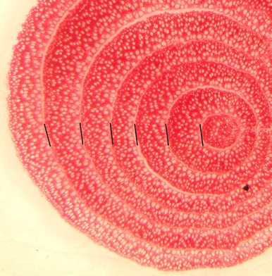 Root cross-section of Penstemon venustus