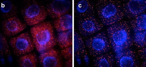 Advancing the ability to image single RNA molecules at the cellular level