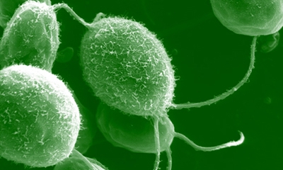 Development of new codon optimisation tools and development of a synthetic gene expression system in the green alga Chlamydomonas reinhardtii