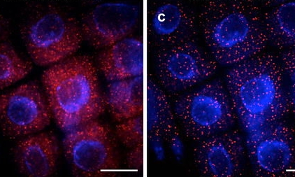 Advancing the ability to image single RNA molecules at the cellular level