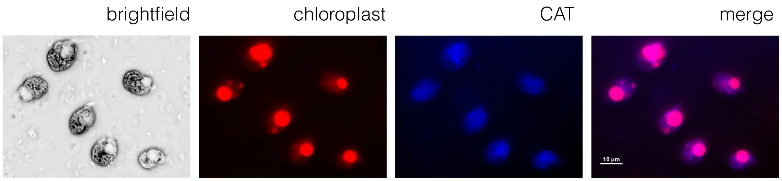 eLife 8:e45292 Figure 5: A chloroplast localization for chloramphenicol acetyl transferase.