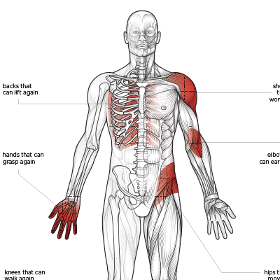 Anatomy-thumbnail.gif