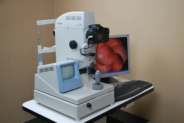 digital Retinal photography