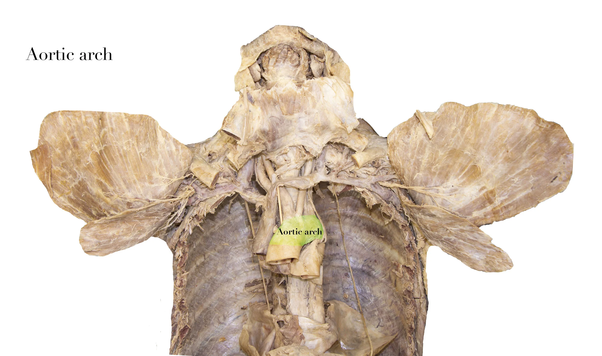 AorticArch_editedimage_labelled2.jpg