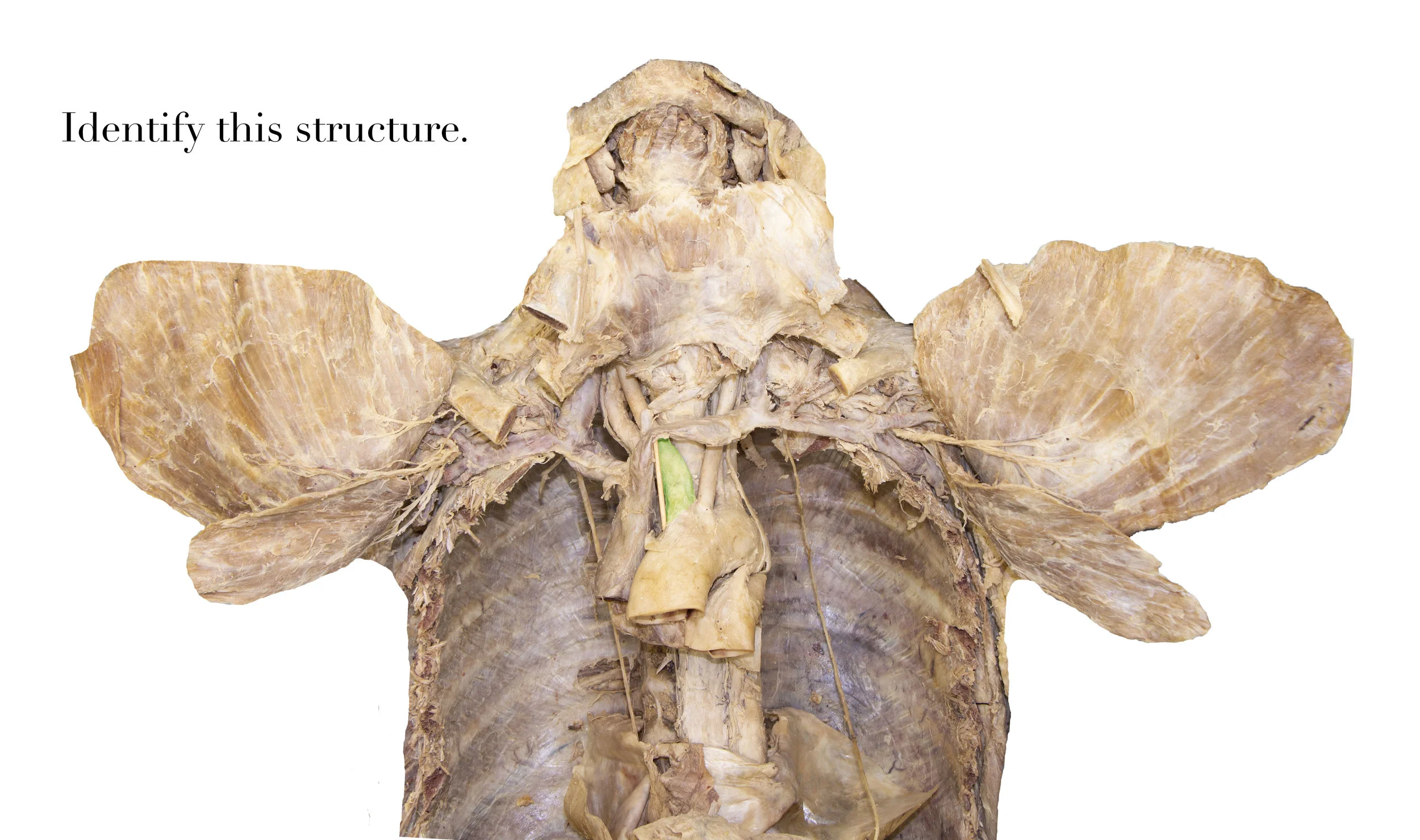 BrachiocephalicArtery_editedimage_identify.jpg