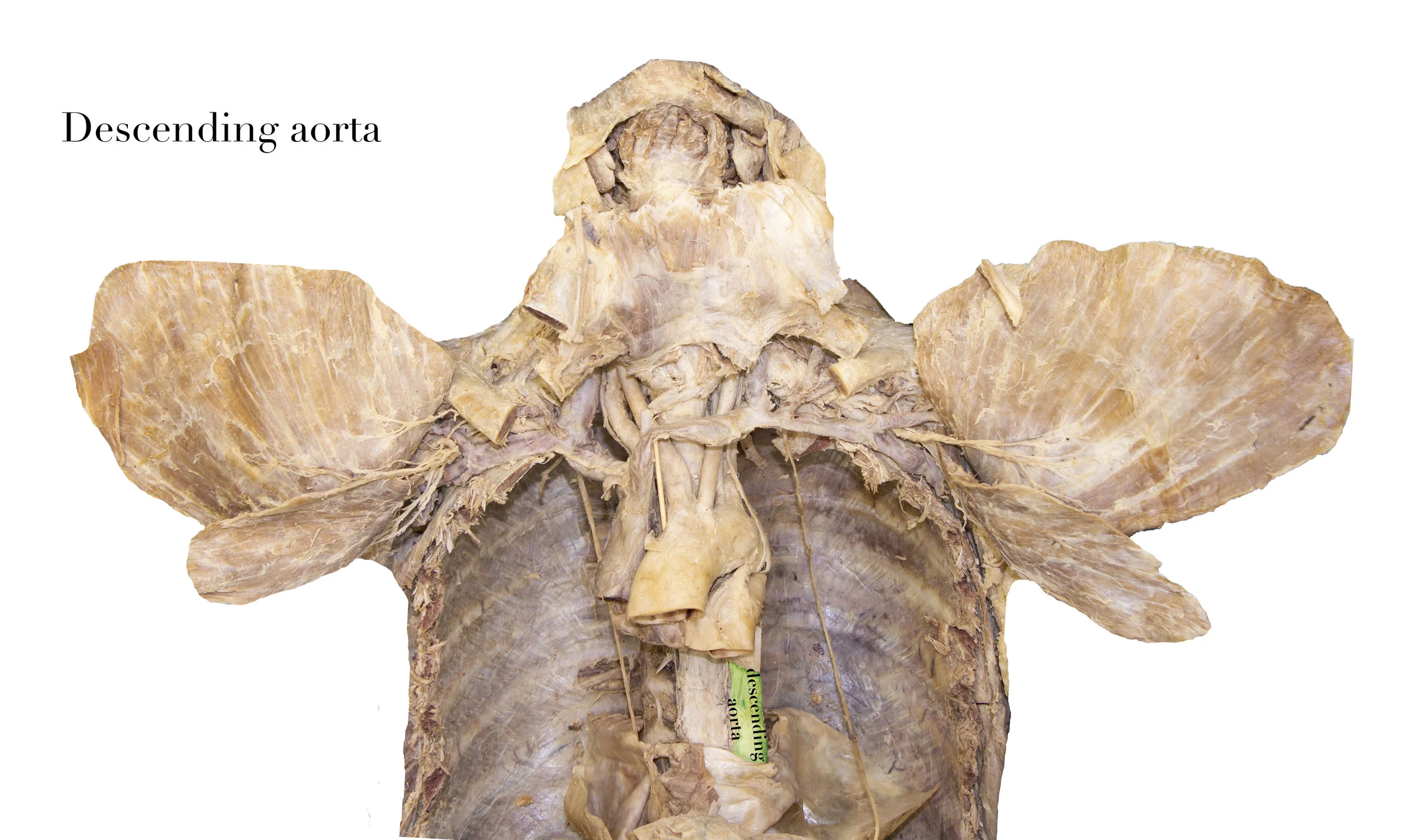 DescendingAorta_editedimage_labelled2.jpg