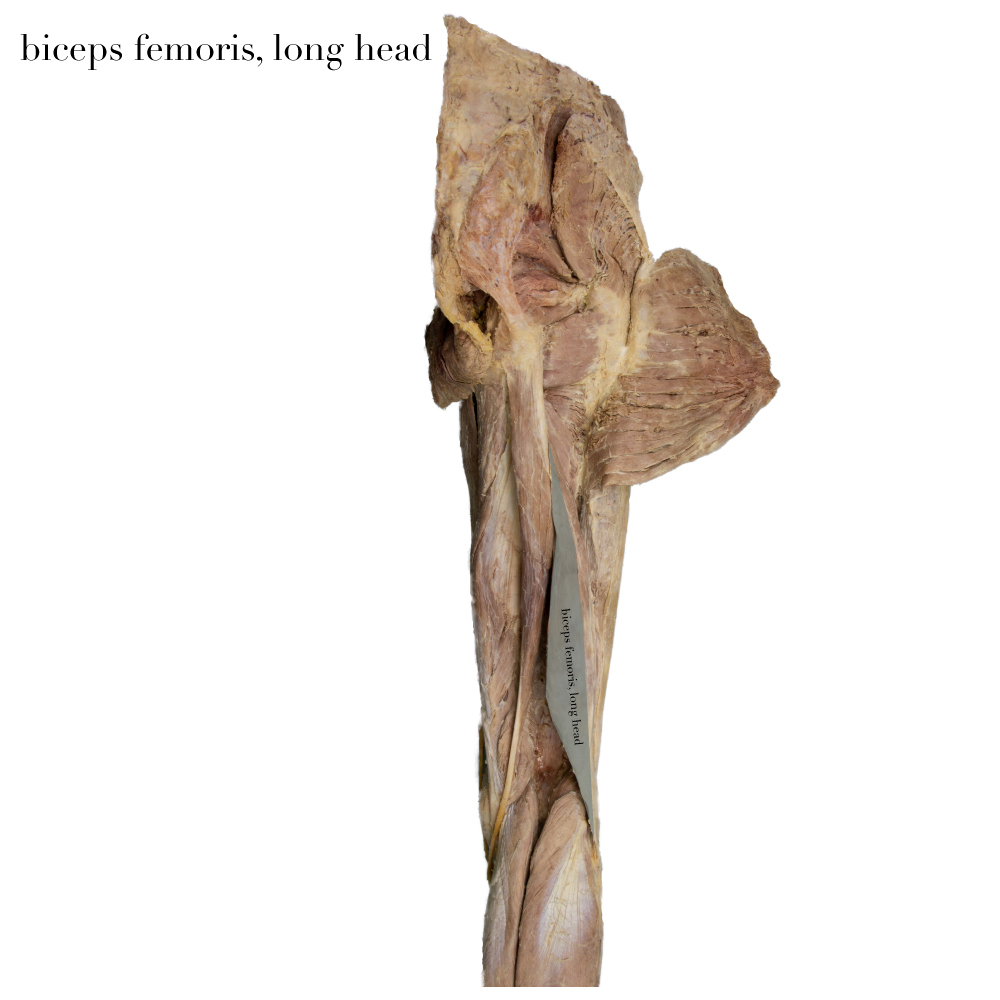 BicepsFemorisLongHead_editedimage_labelled.jpg