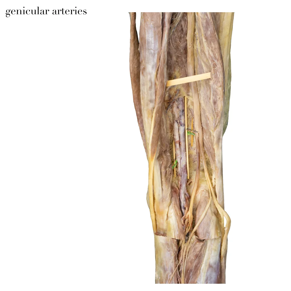 GenicularArteries_editedimage_labelled.jpg