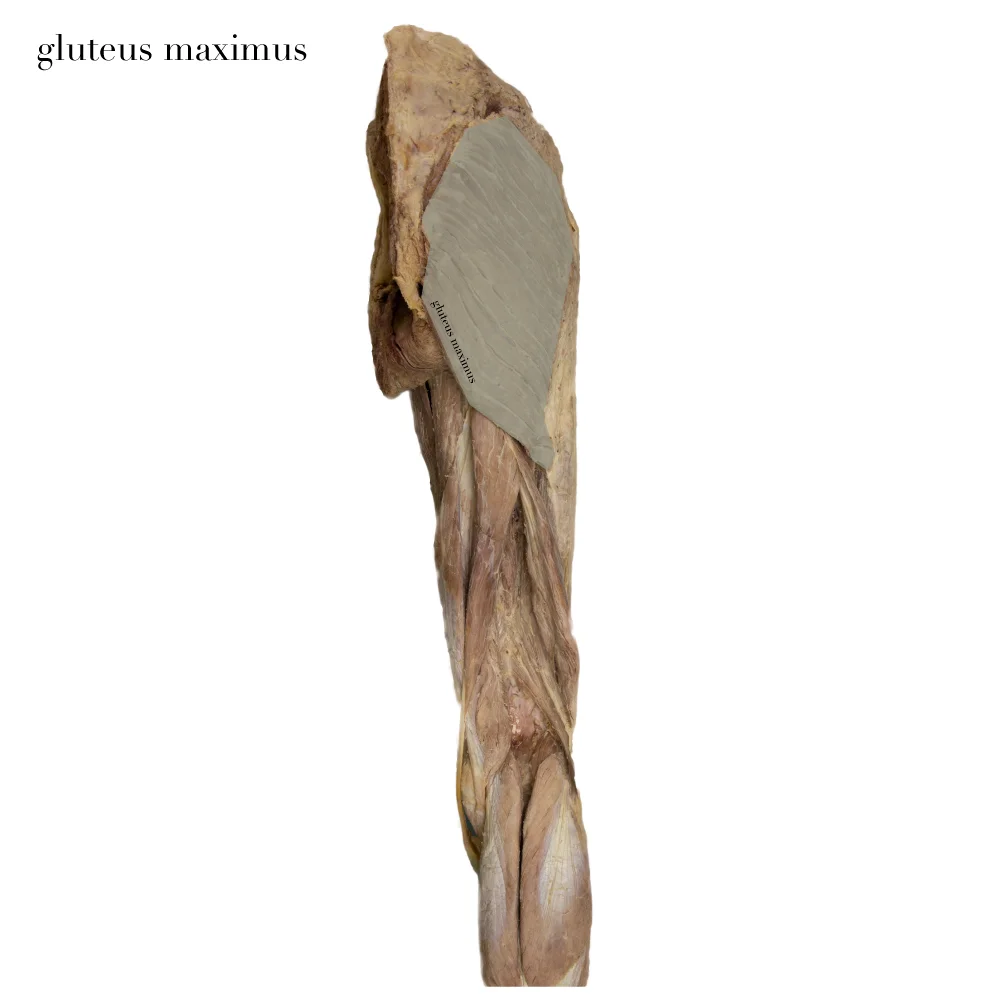 Gluteusmaximus_editedimage_labelled.jpg