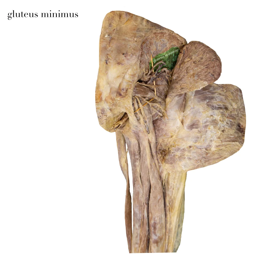 GluteusMinimus_editedimage_labelled.jpg
