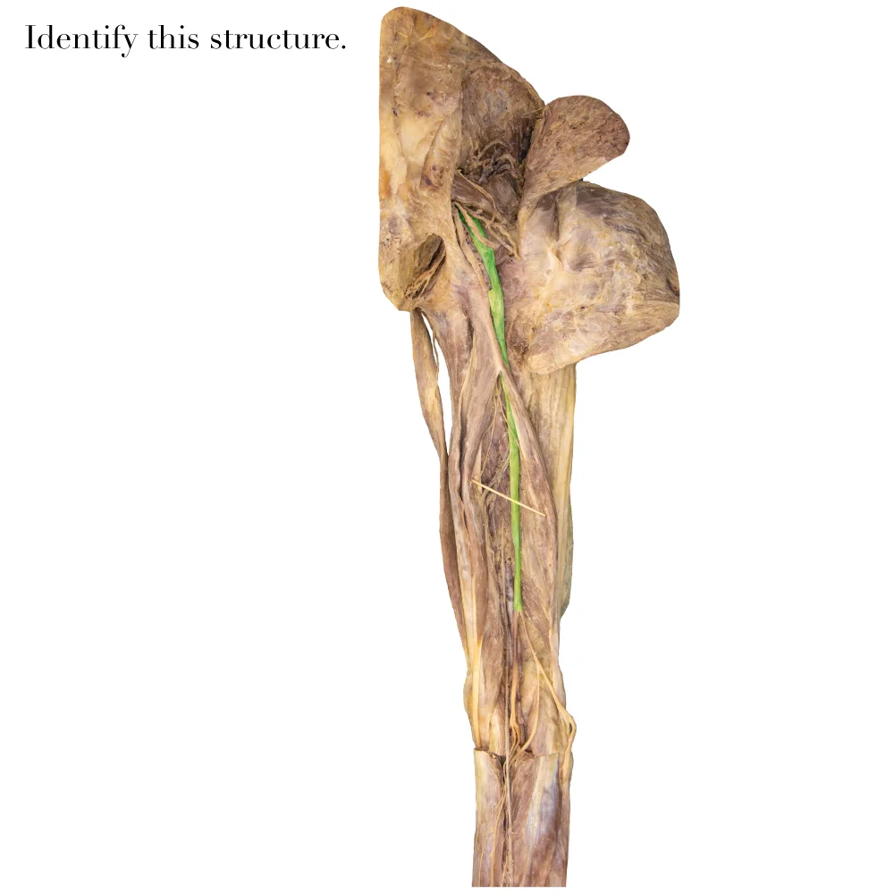 SciaticNerve_editedimage_identify.jpg