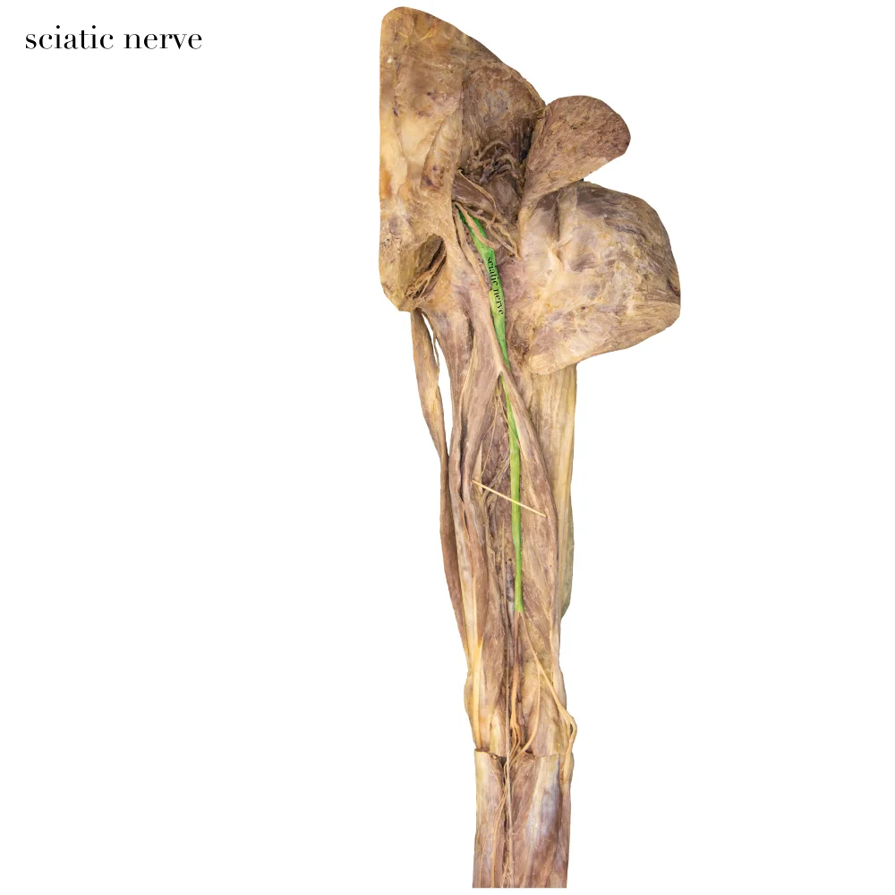 SciaticNerve_editedimage_labelled.jpg