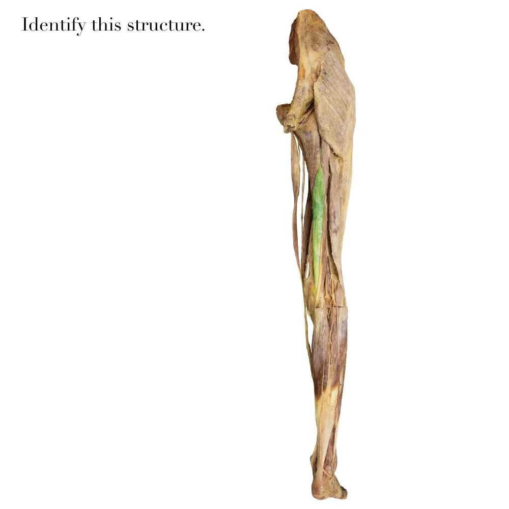 Semimembranosus_editedimage_identify.jpg