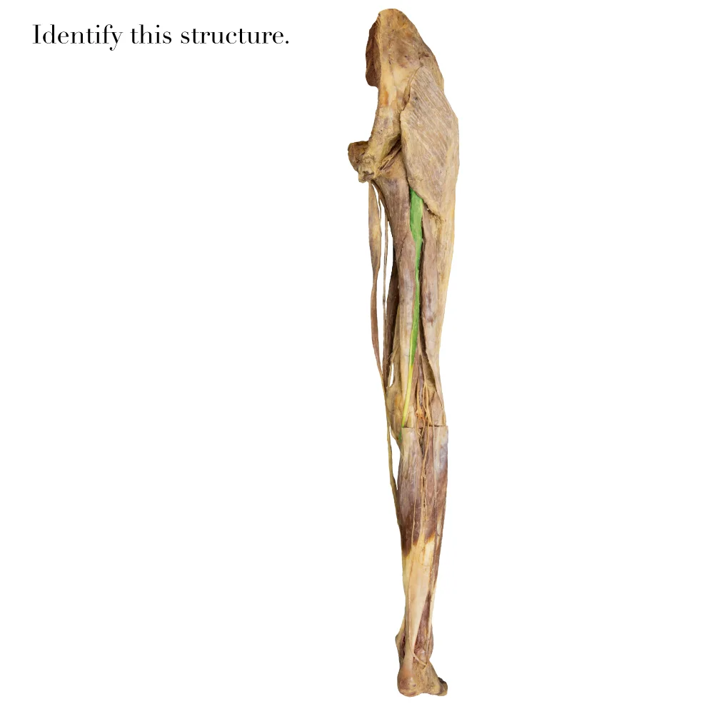 Semitendinosus_editedimage_identify.jpg