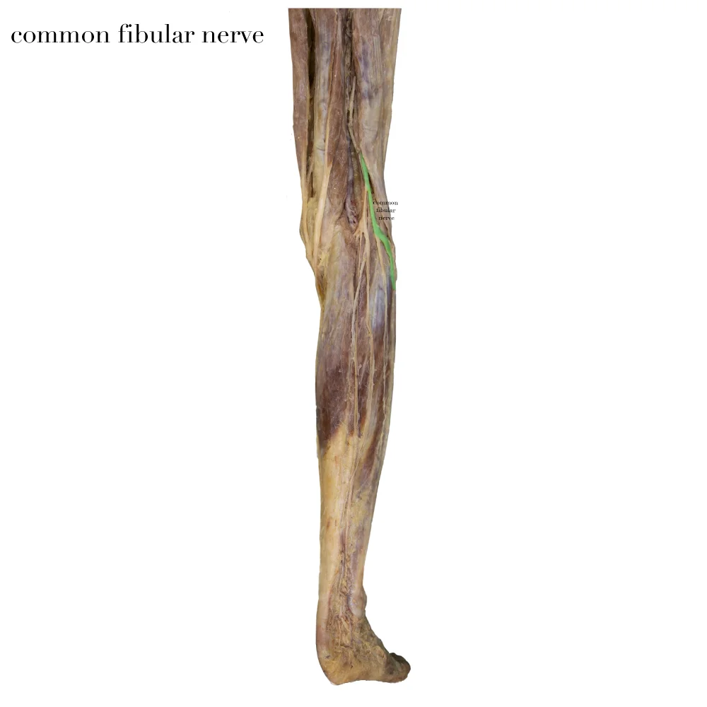 CommonFibularNerve_editedimage_labelled.jpg