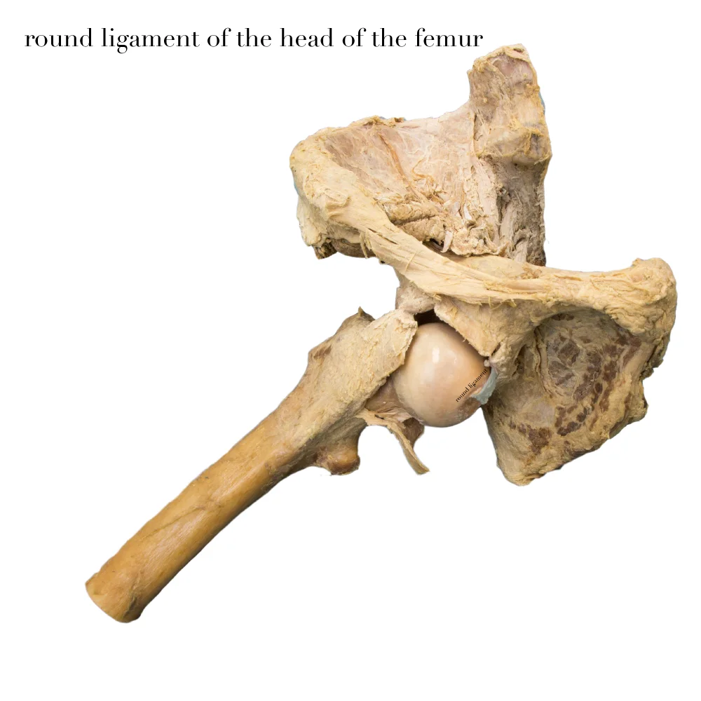 RoundLigamentofFemur_editedimage_labelled.jpg