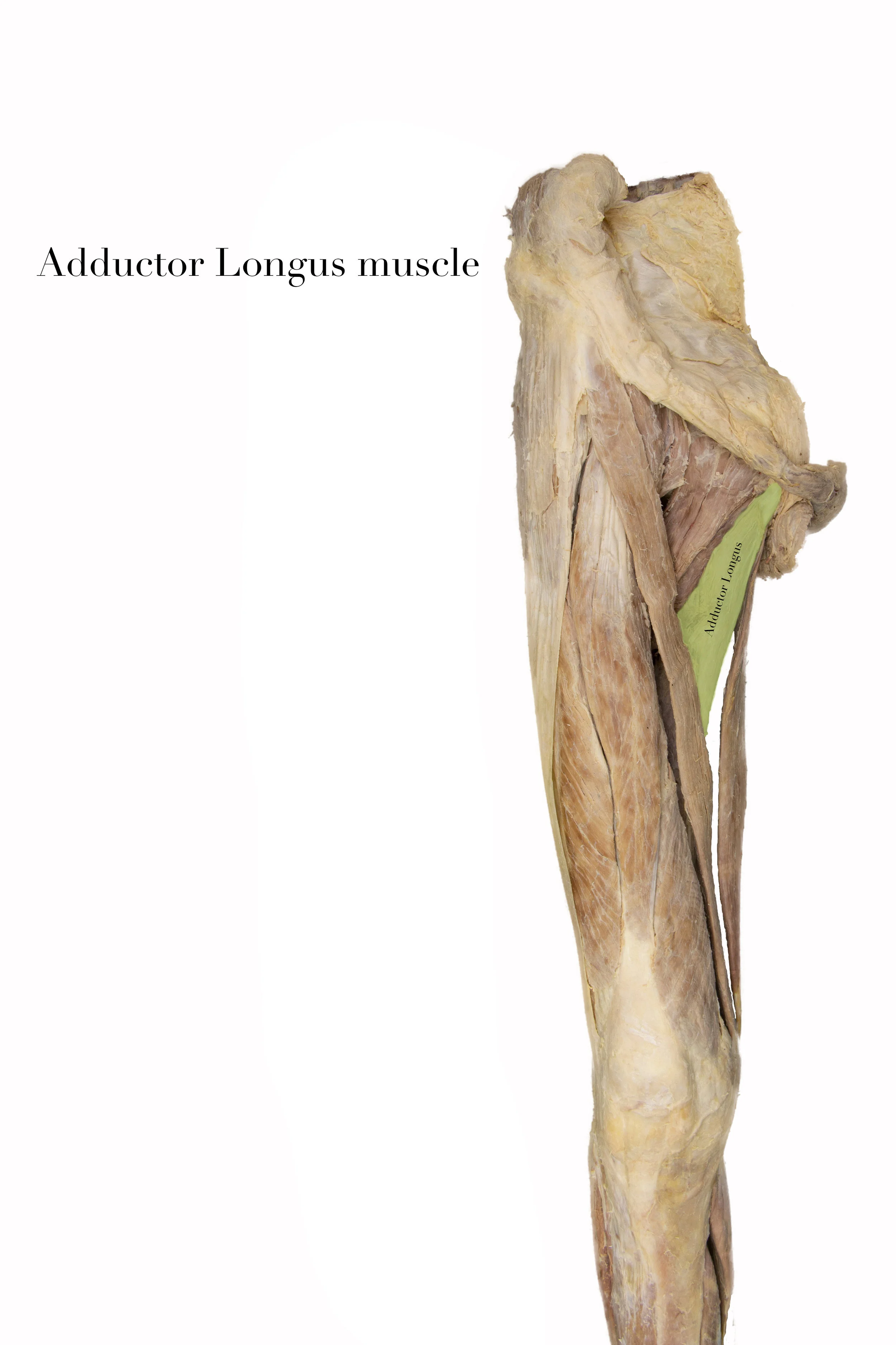 Adductor Longus2.jpg