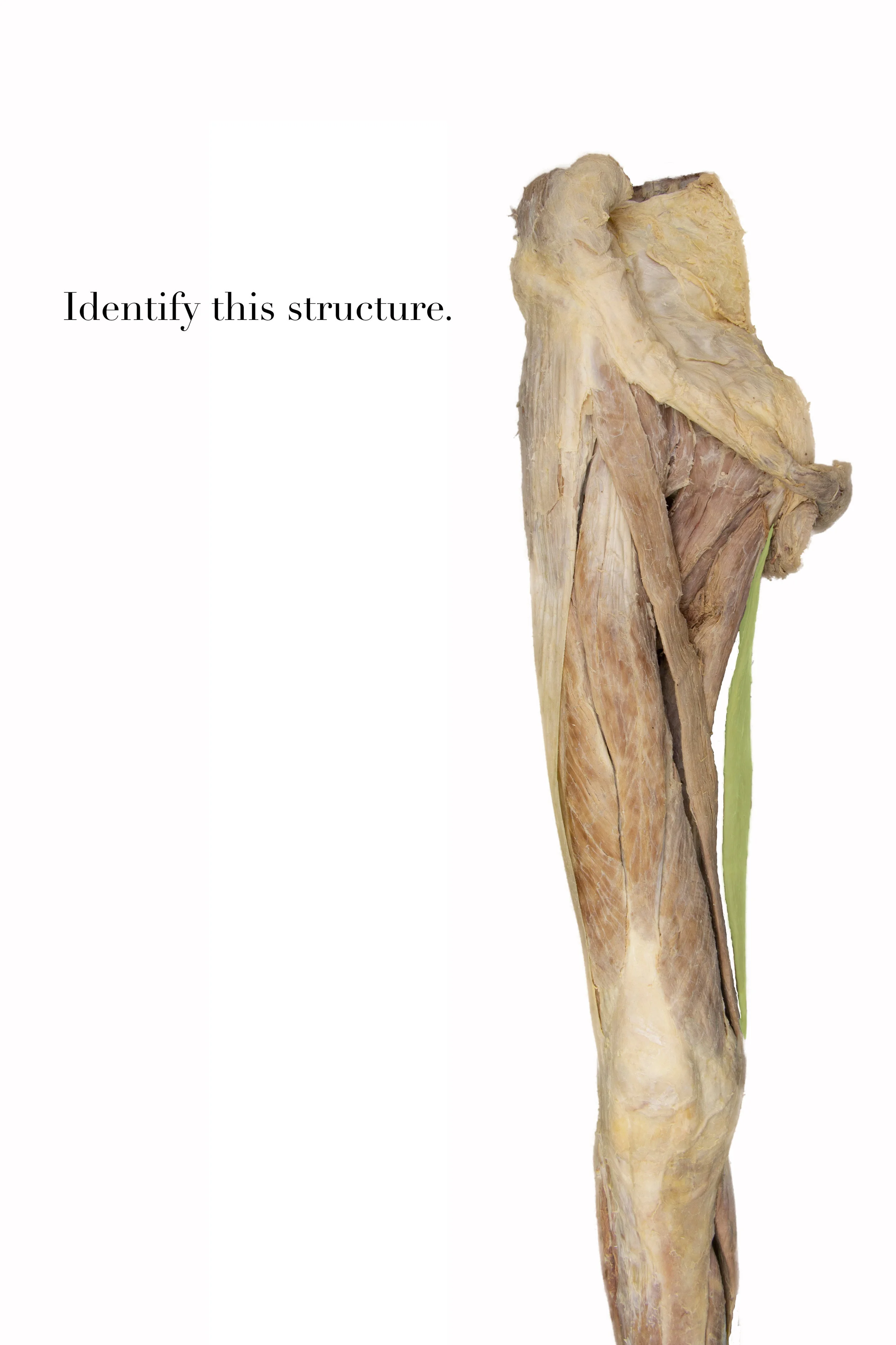 Gracilis1.jpg