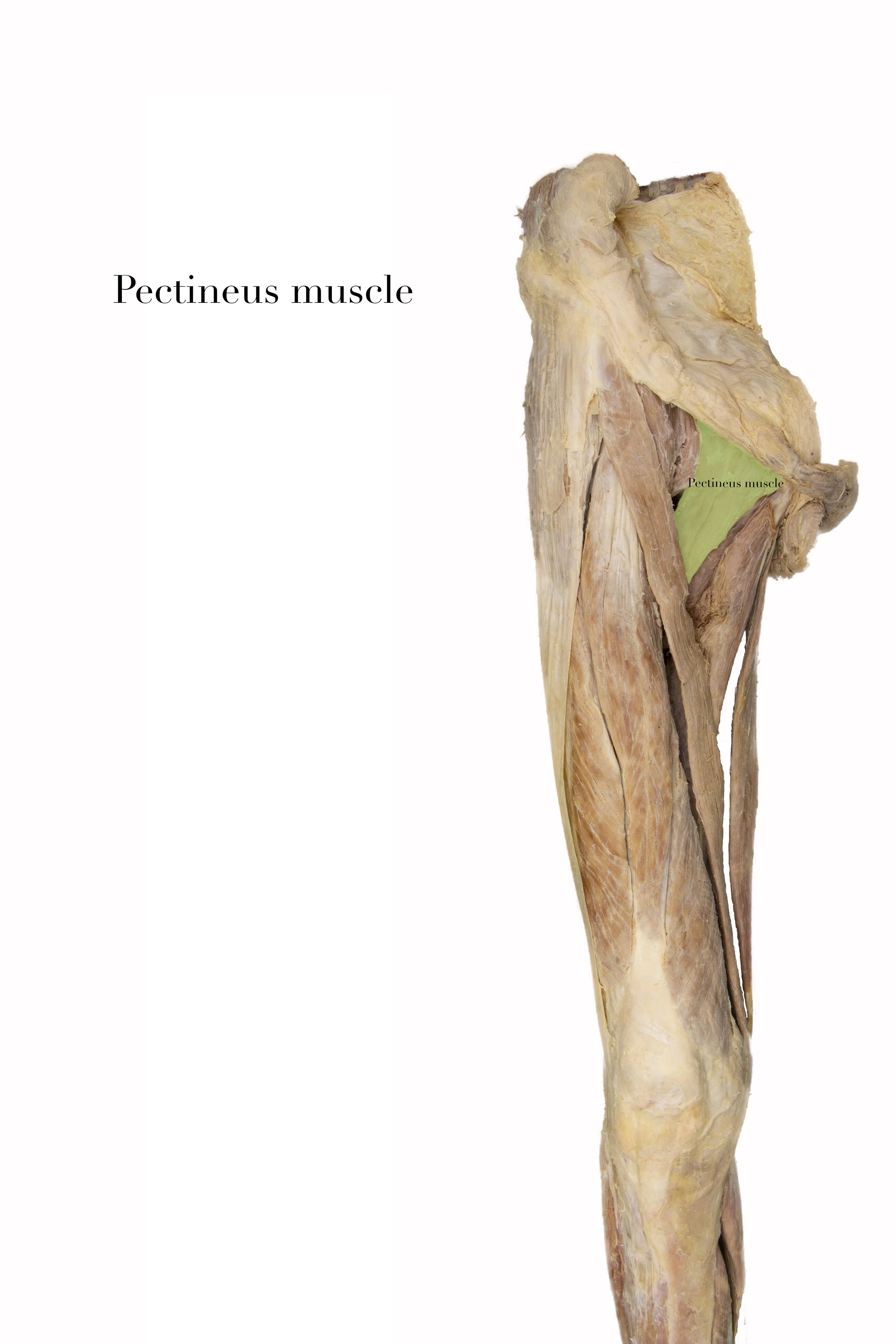 Pectineus2.jpg