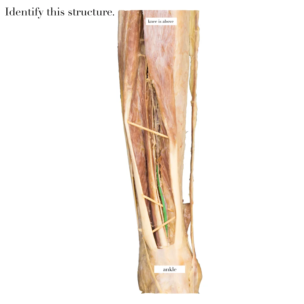AnteriorTibialArtery_editedimage_identify.jpg