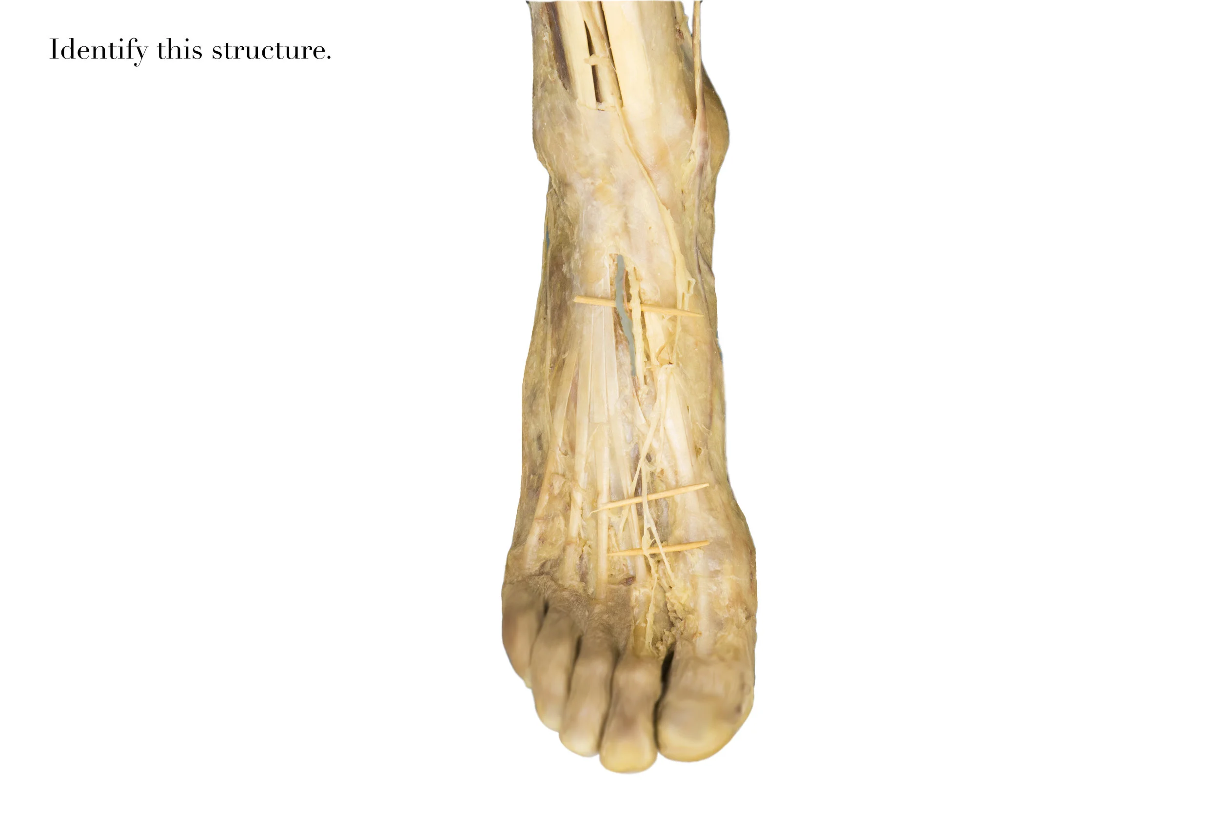 DorsalisPedisArtery_edited_identify.jpg