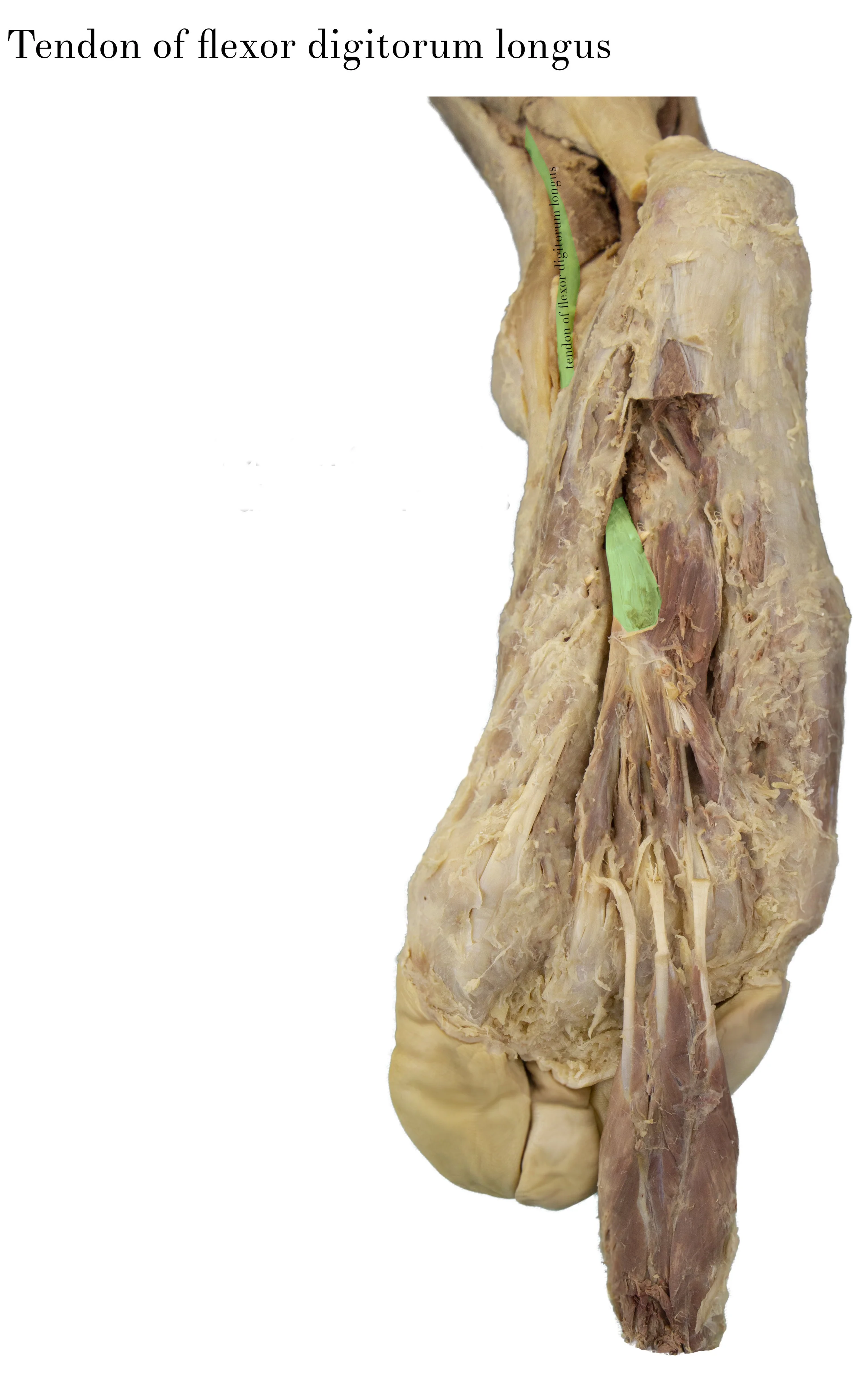 SoleTendonOfFlexorDigitorumLongus_edited_labelled.jpg