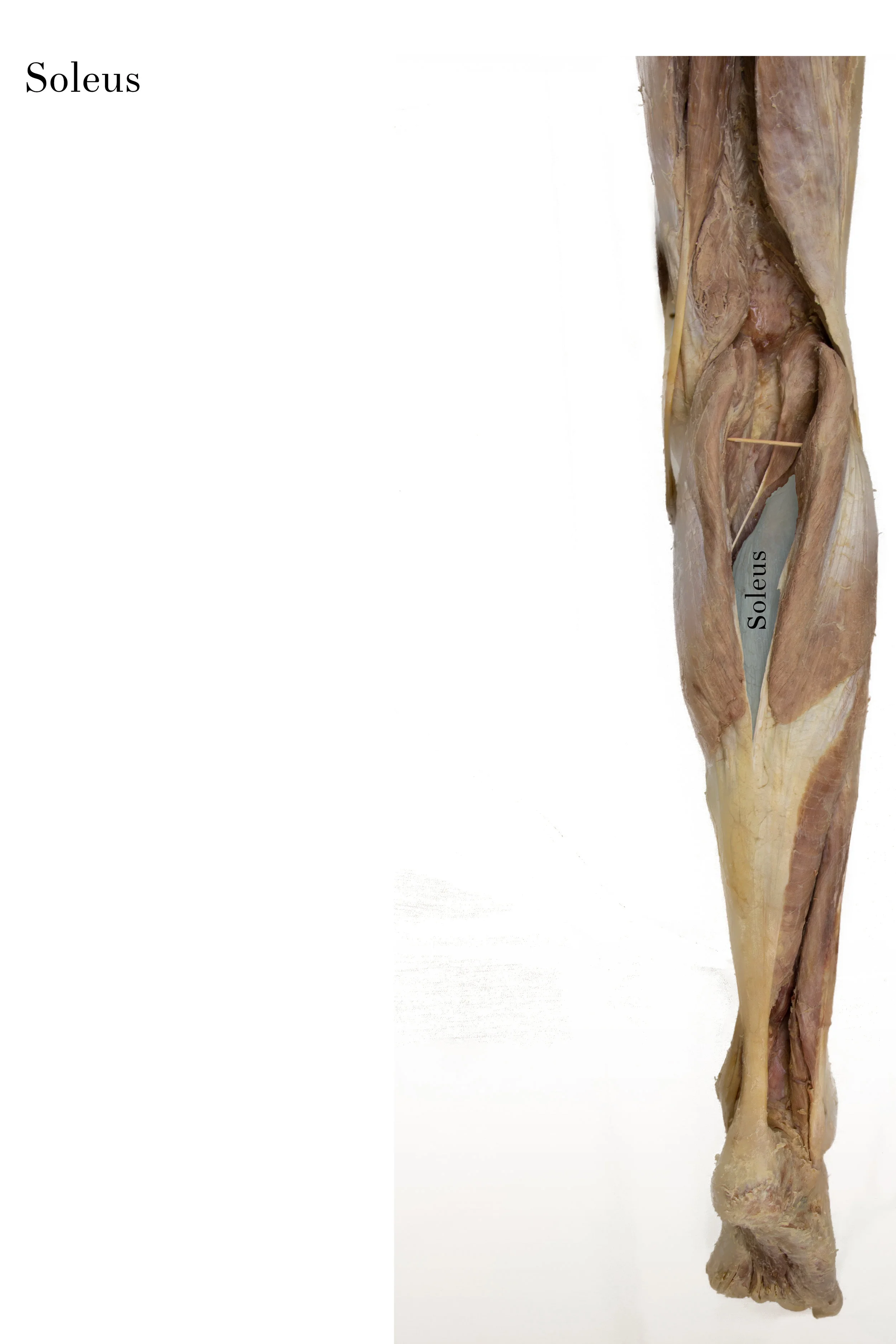 Soleus_edited_labelled.jpg