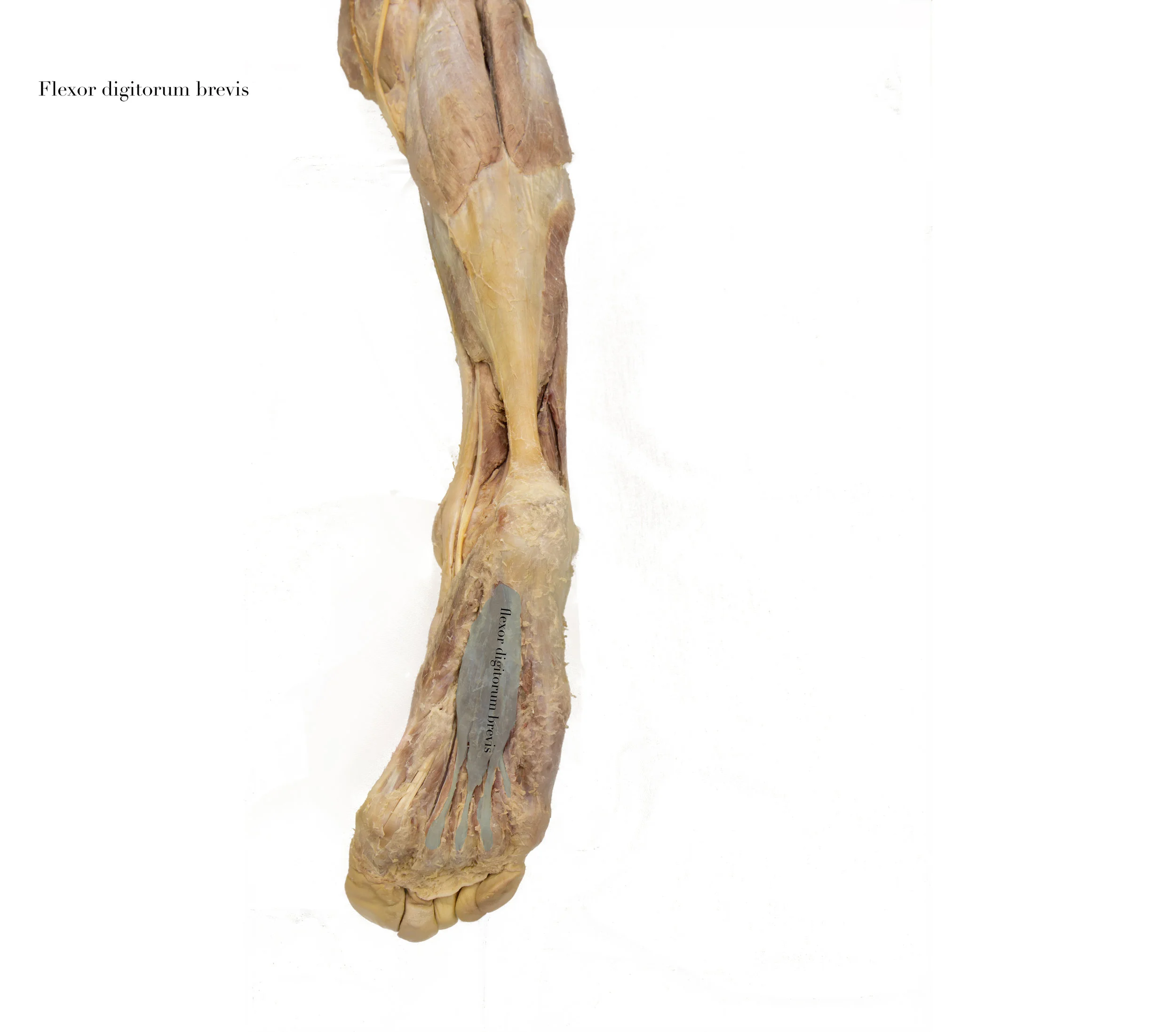 FlexorDigitorumBrevis _edited_labelled.jpg