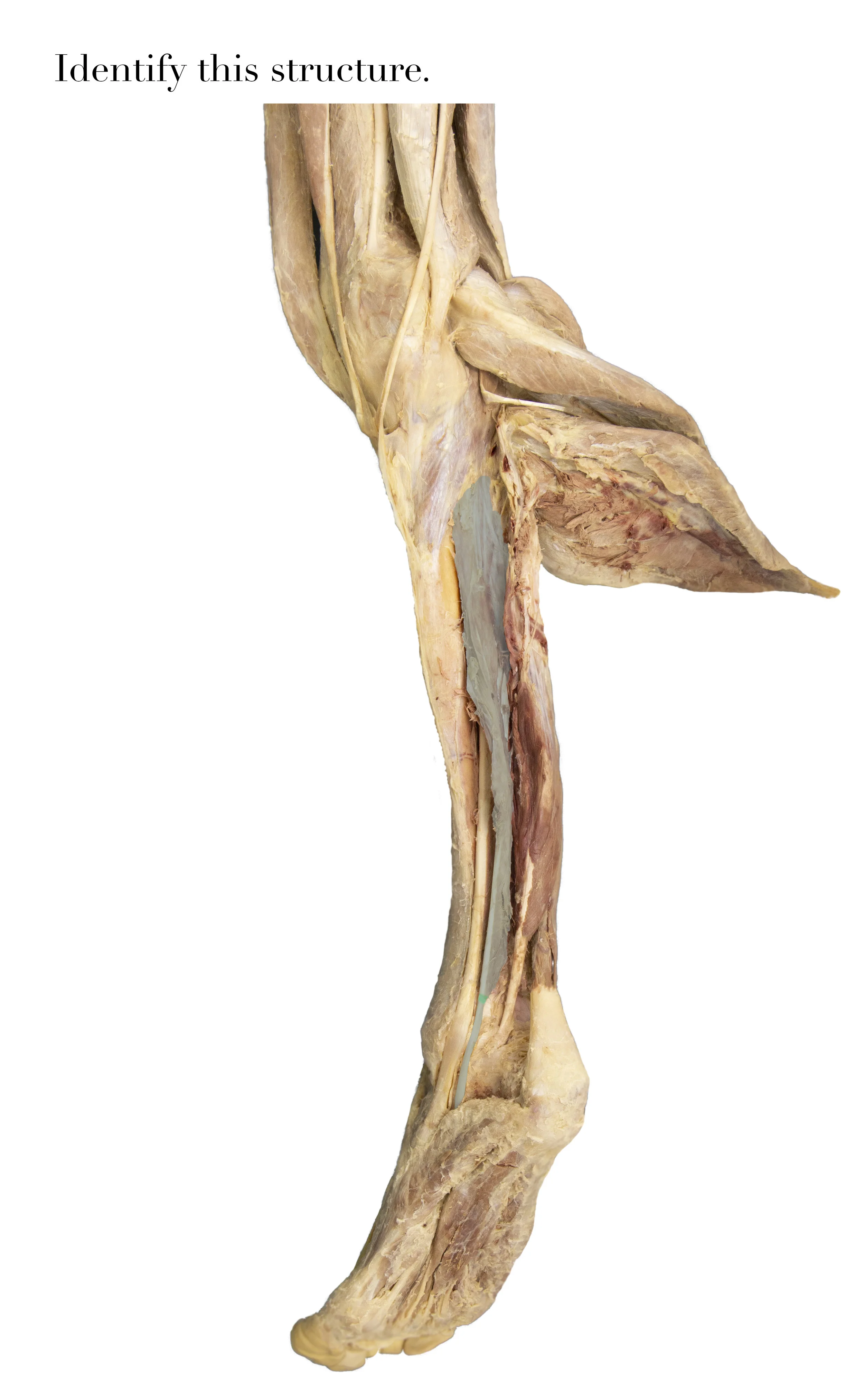FlexorDigitorumLongus_edited_identify.jpg