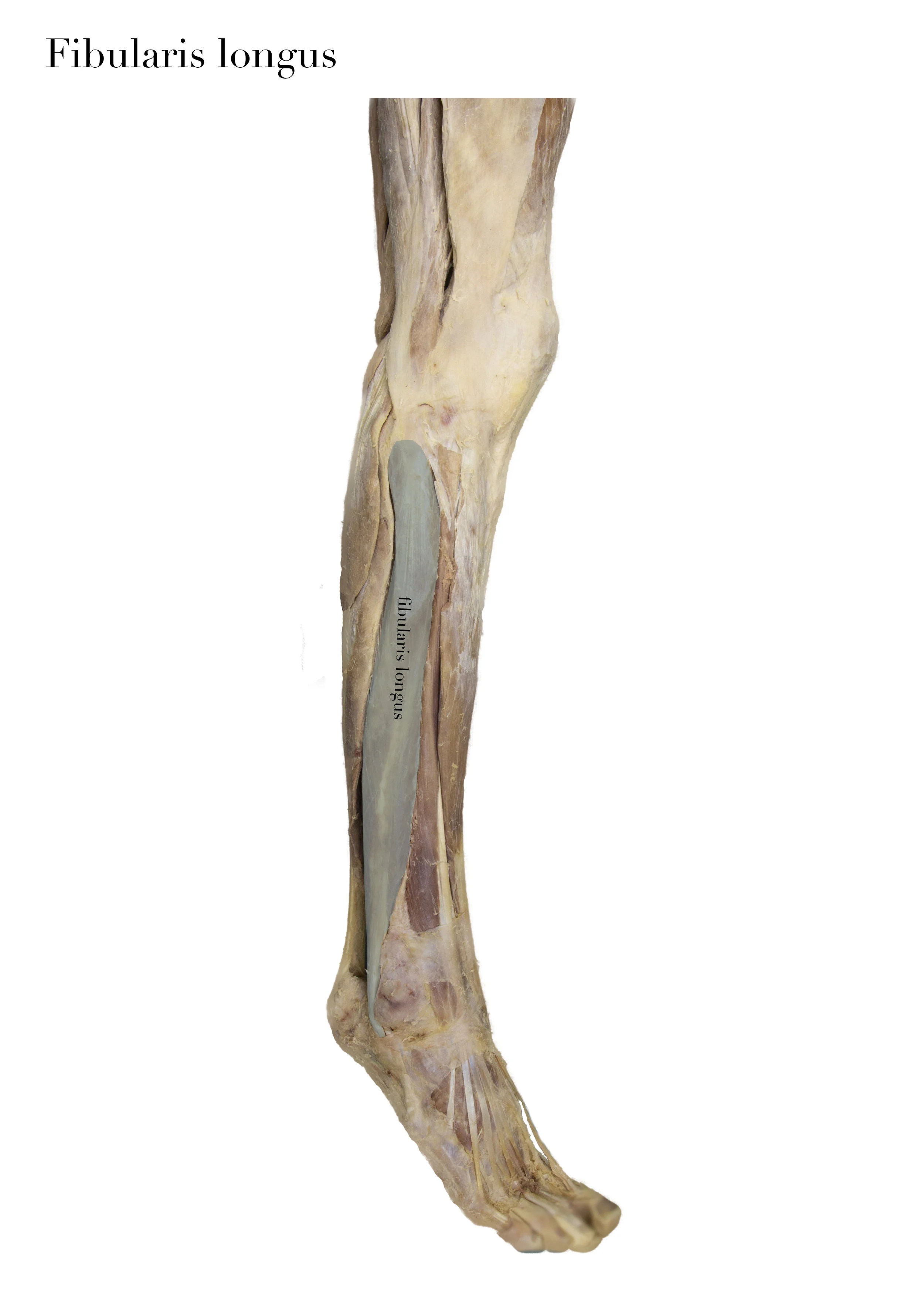 FibularisLongus_edited_labelled.jpg