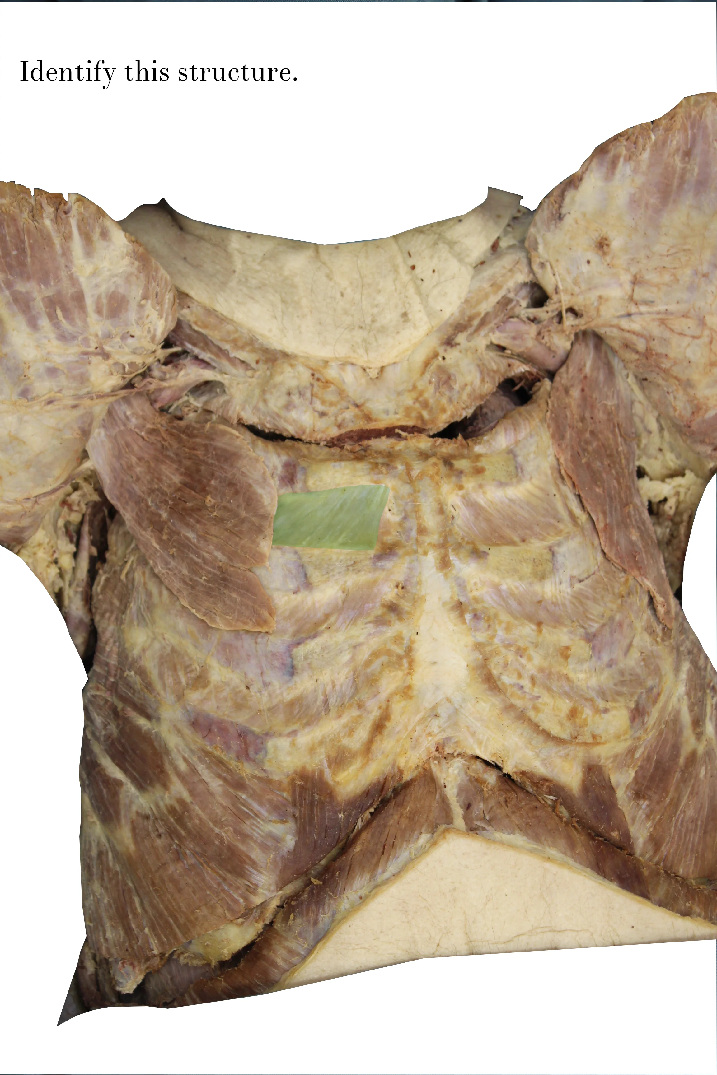 Copy of IMG_9763_internal_intercostal_muscle_identify.jpg
