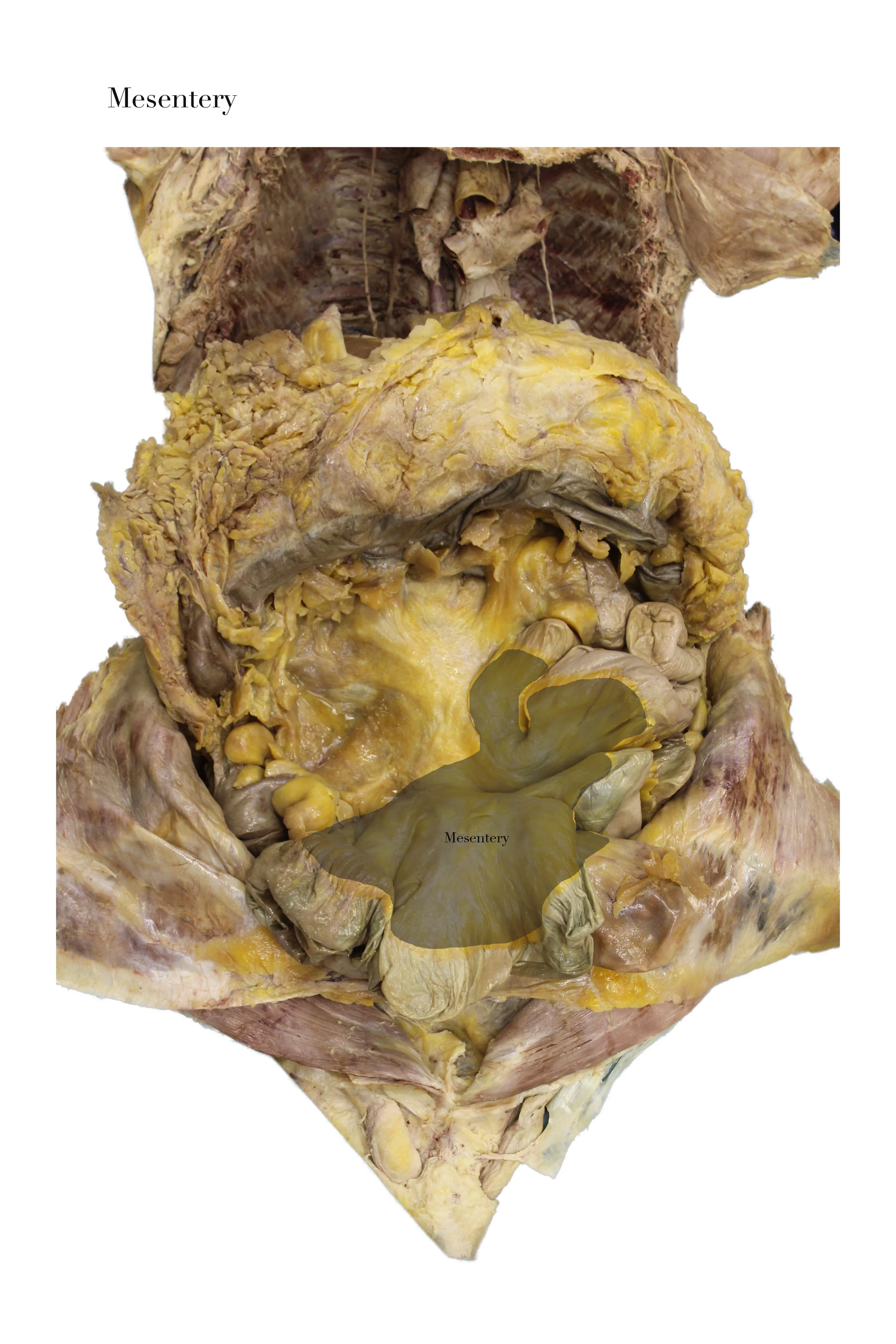 Mesentery_edited_labelled.jpg