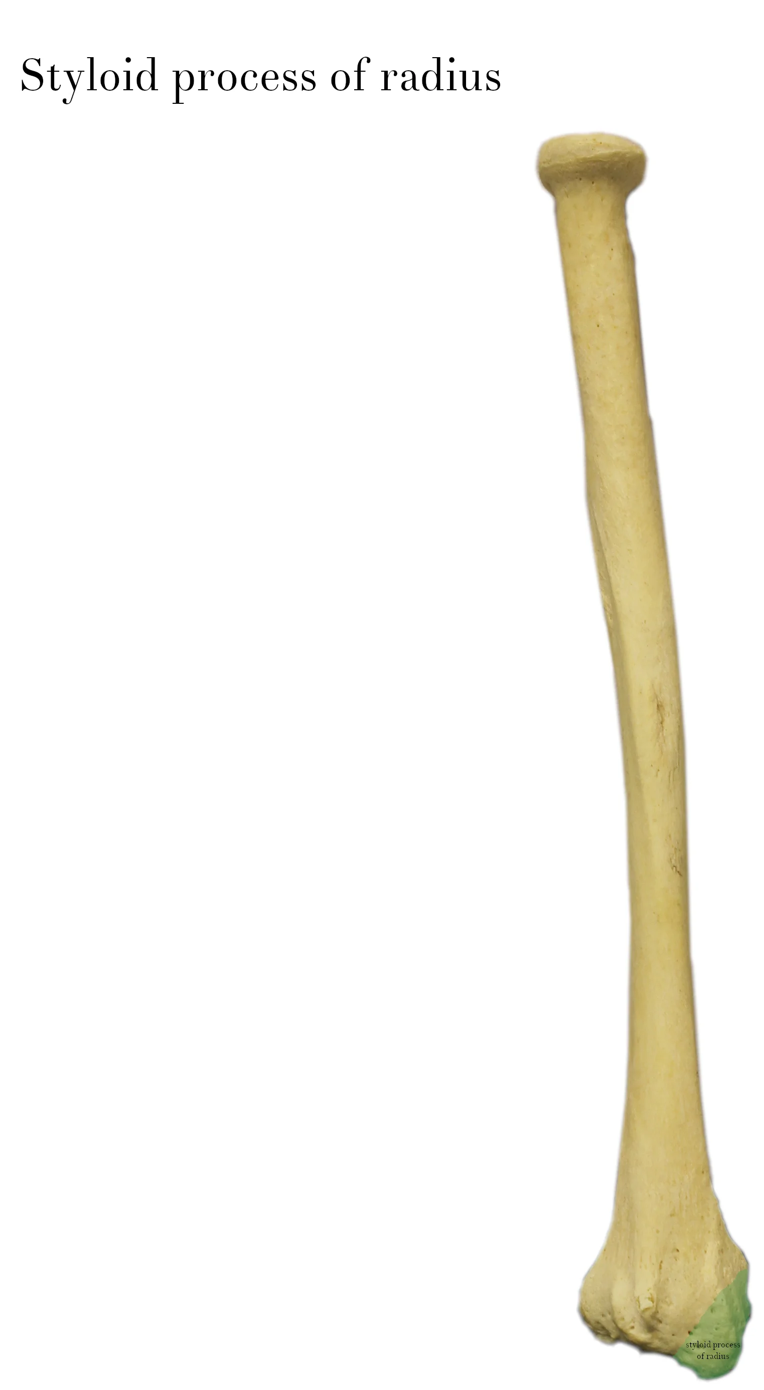 IMG_9903_styloid_process_of_radius_labelled.jpg