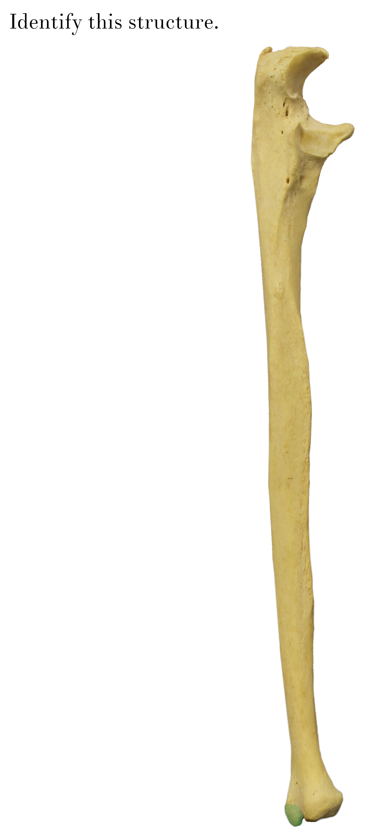 IMG_9898_styloid_process_of_ulna_identify.jpg