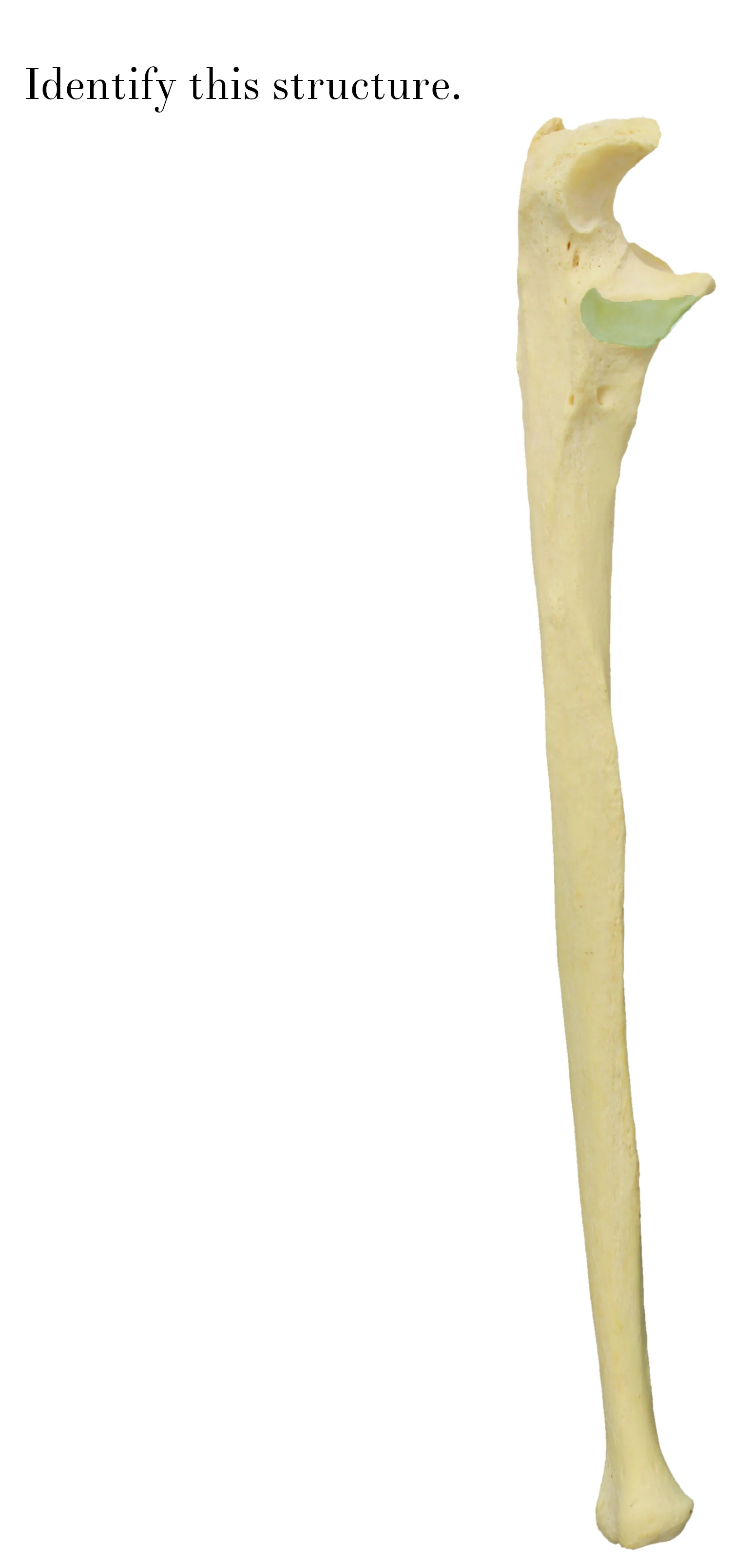 IMG_9895_radial_notch_of_ulna_identify.JPG