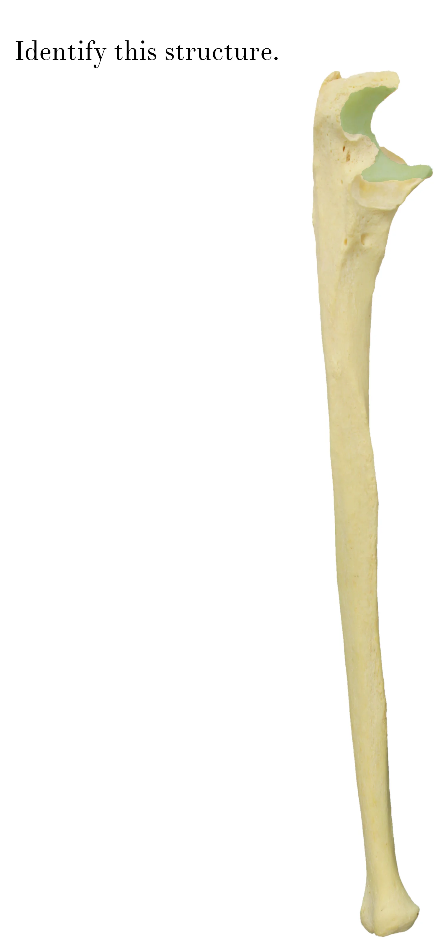 IMG_9895_trochlear_notch_of_ulna_identify.JPG