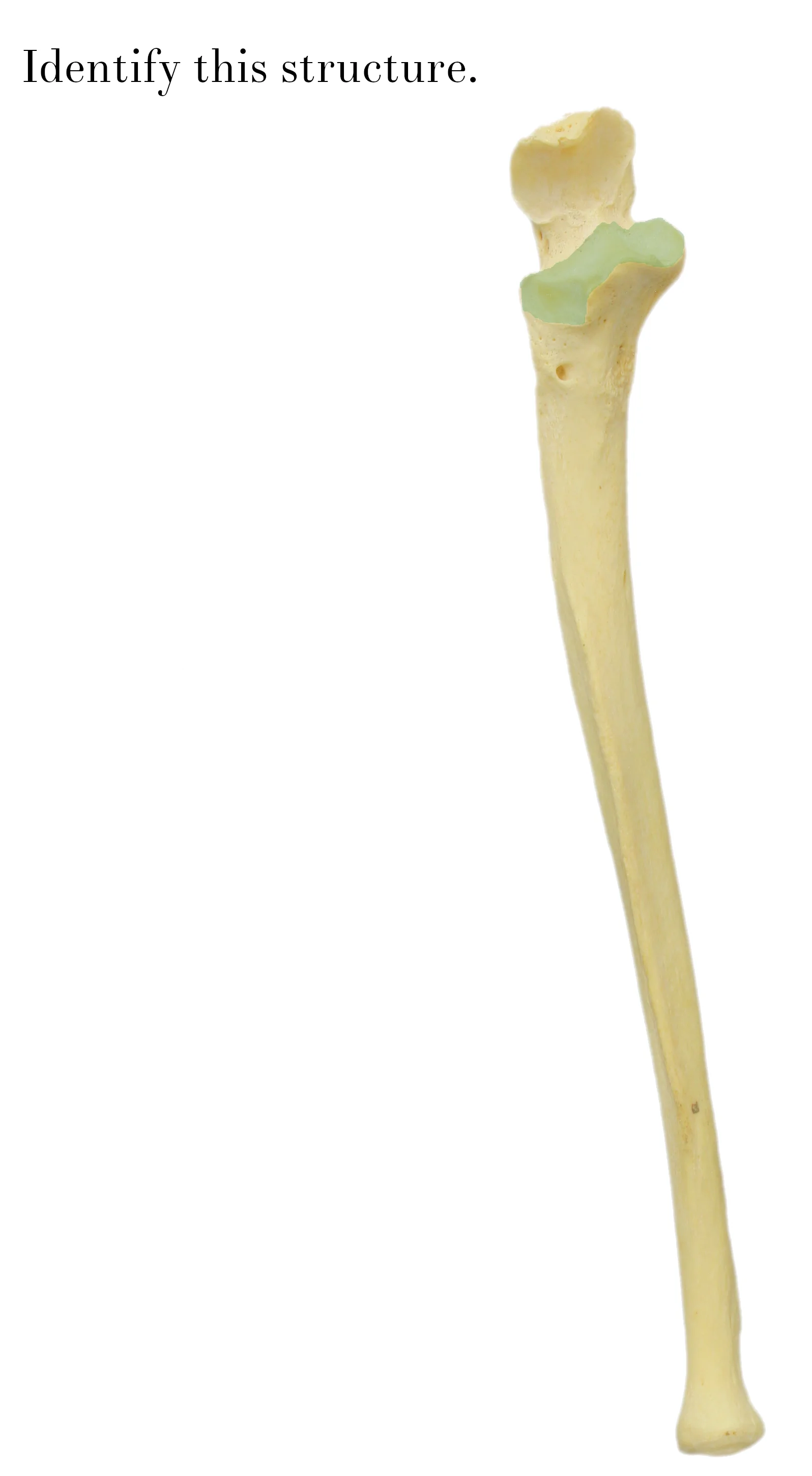 IMG_9892_coronoid_process_of_ulna_identify.jpg
