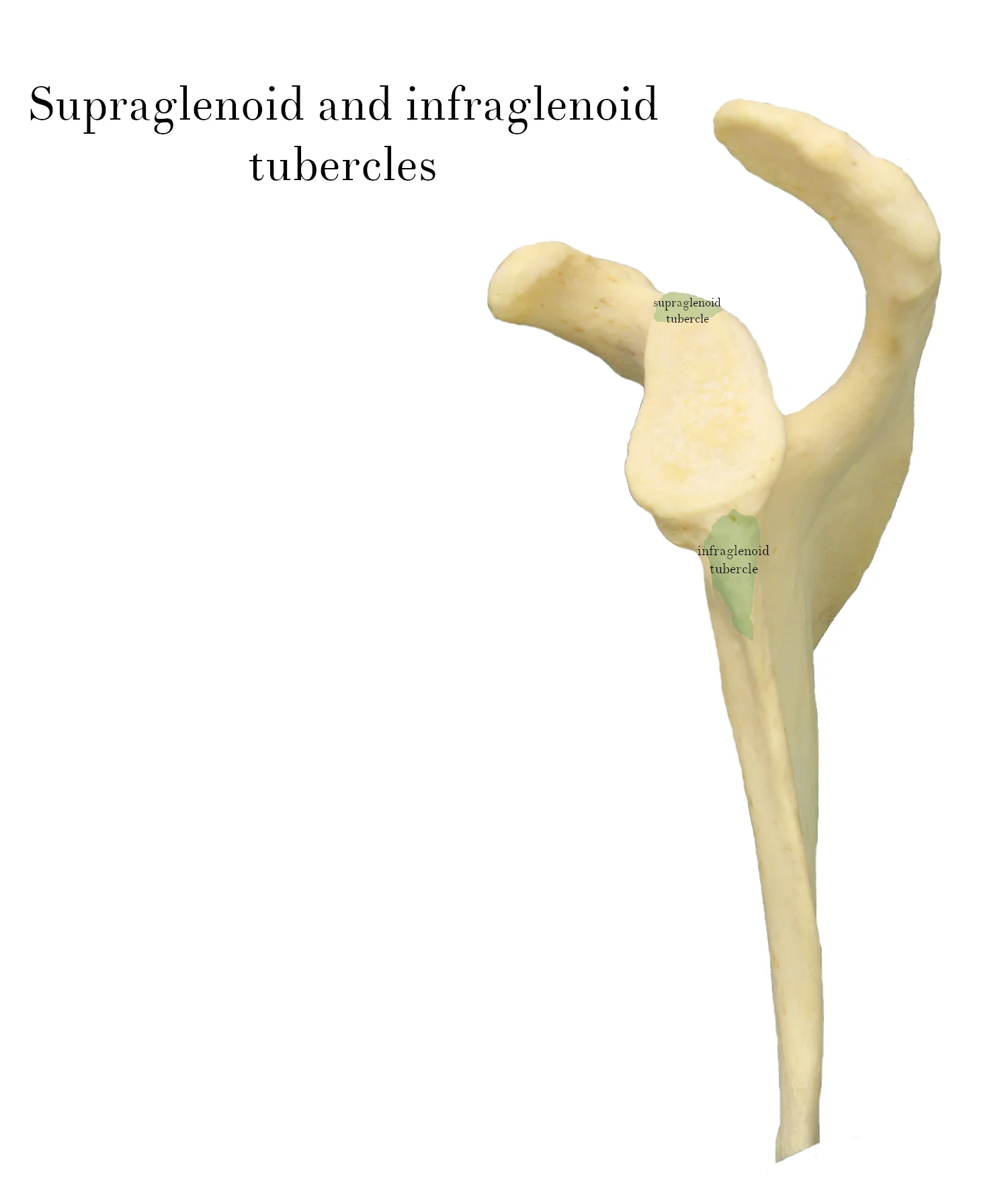 IMG_9879_supraglenoid_infraglenoid_tubercles_labelled.jpg