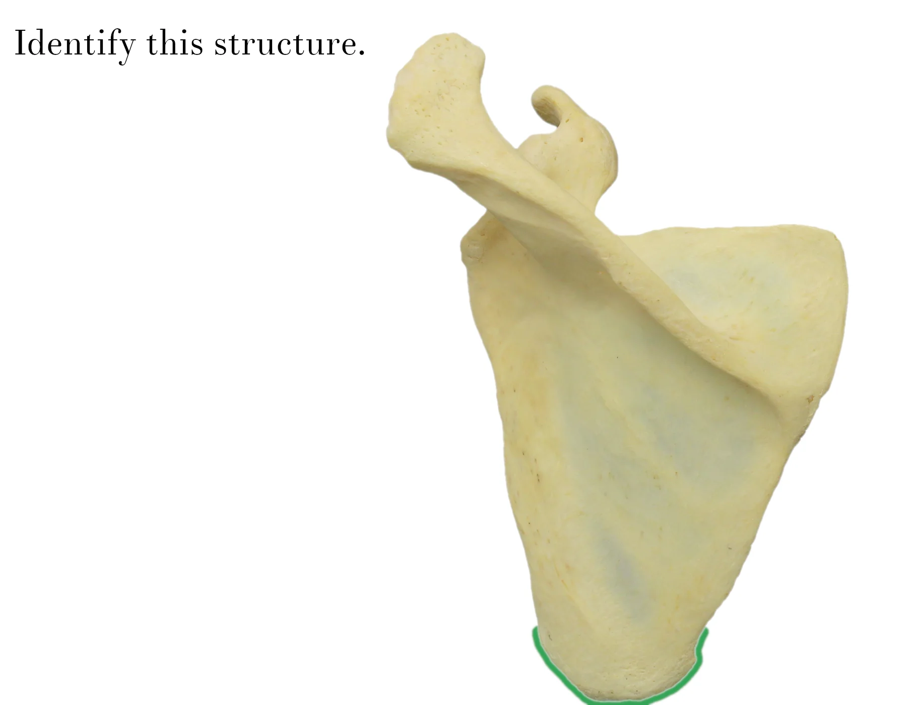 IMG_9877_inferior_angle_of_scapula_identify.jpg