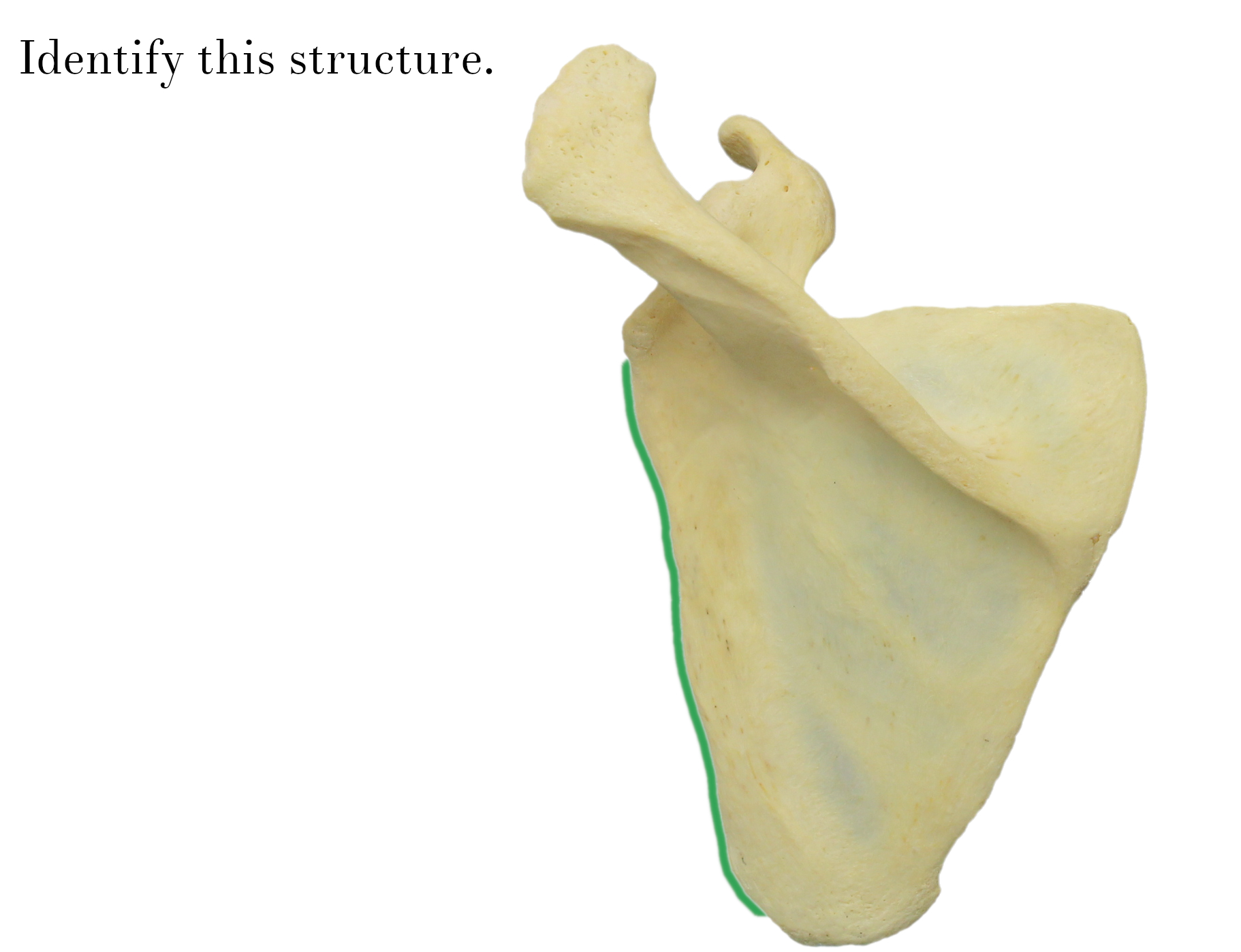 IMG_9877_lateral_border_of_scapula_identify.jpg
