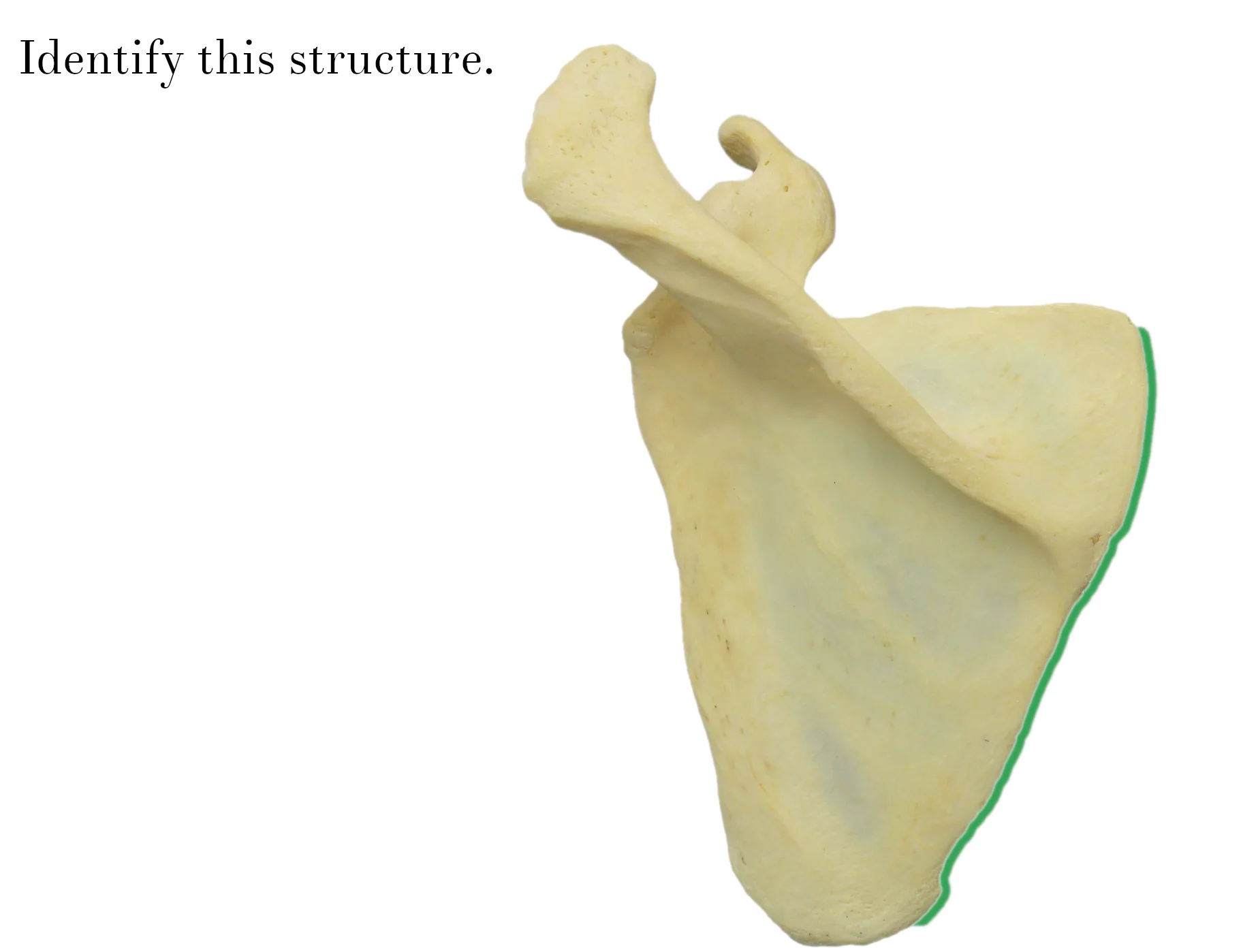 IMG_9877_medial_border_of_scapula_identify.jpg
