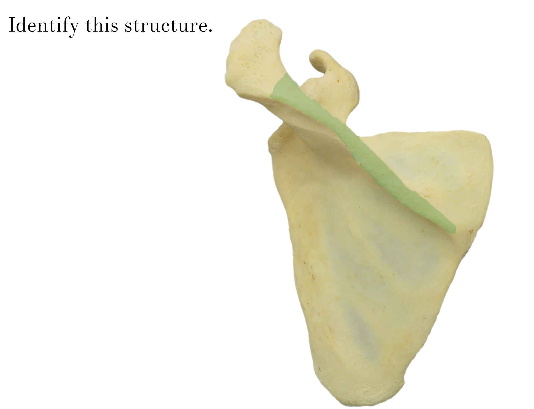 IMG_9877_spine_of_scapula_identify.jpg