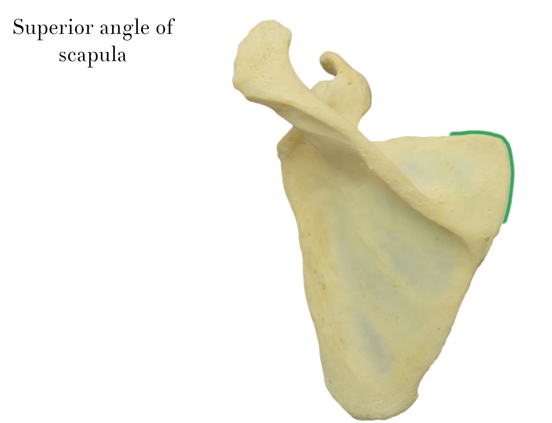 IMG_9877_superior_angle_of_scapula_labelled.jpg
