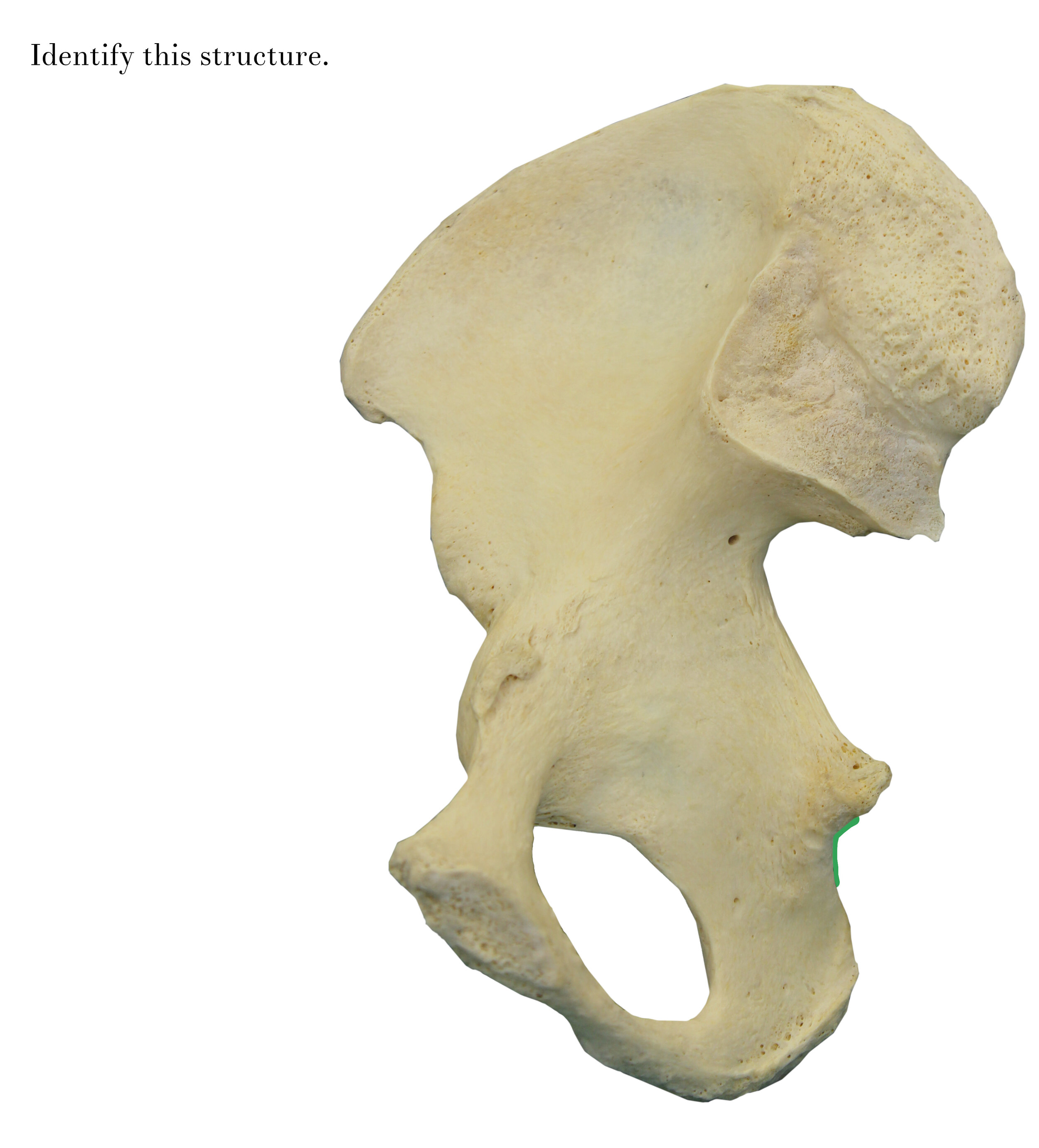 IMG_0632_lesser_sciatic_notch_identify.jpg