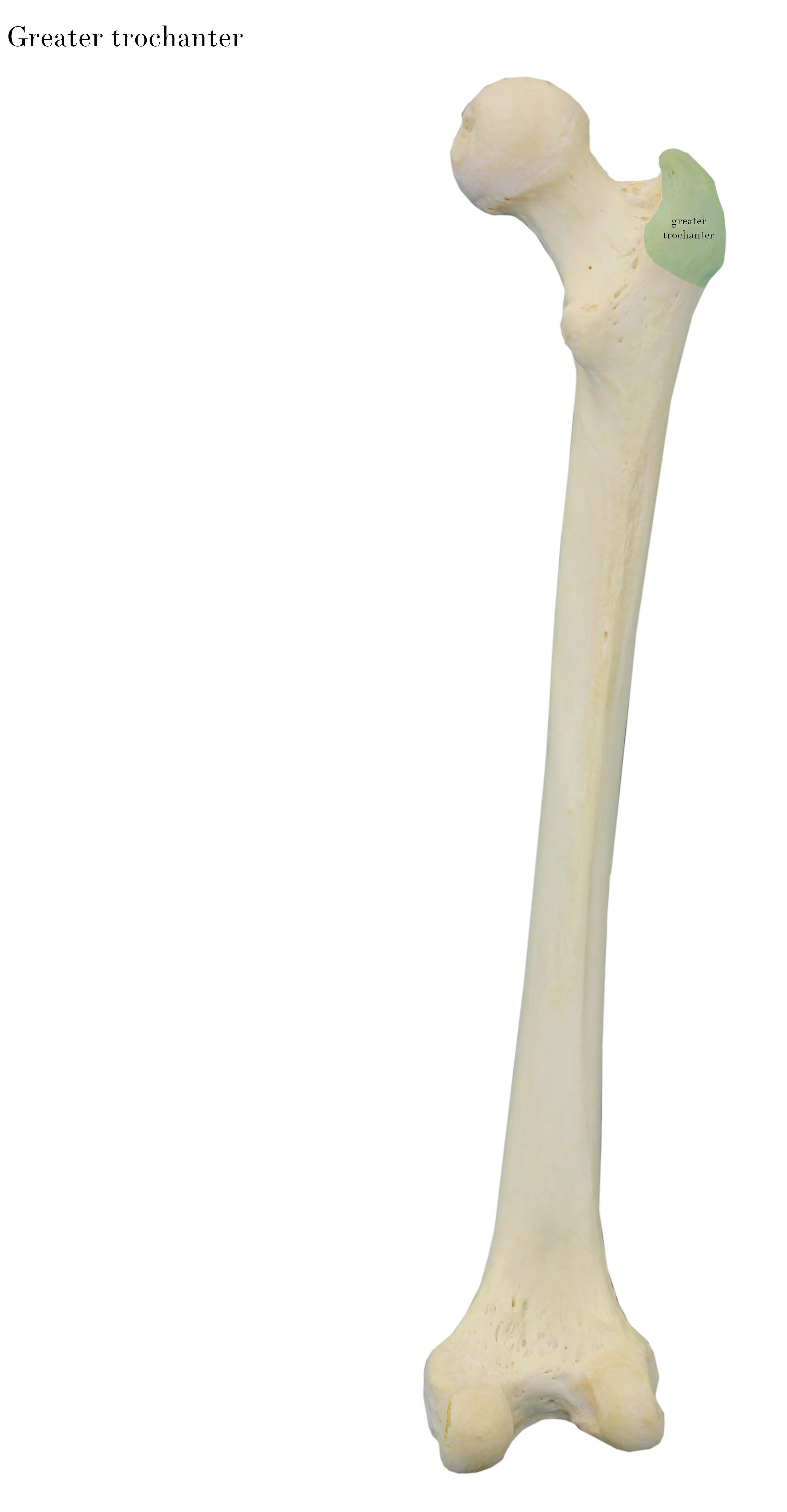 IMG_0642_greater_trochanter_labelled.jpg