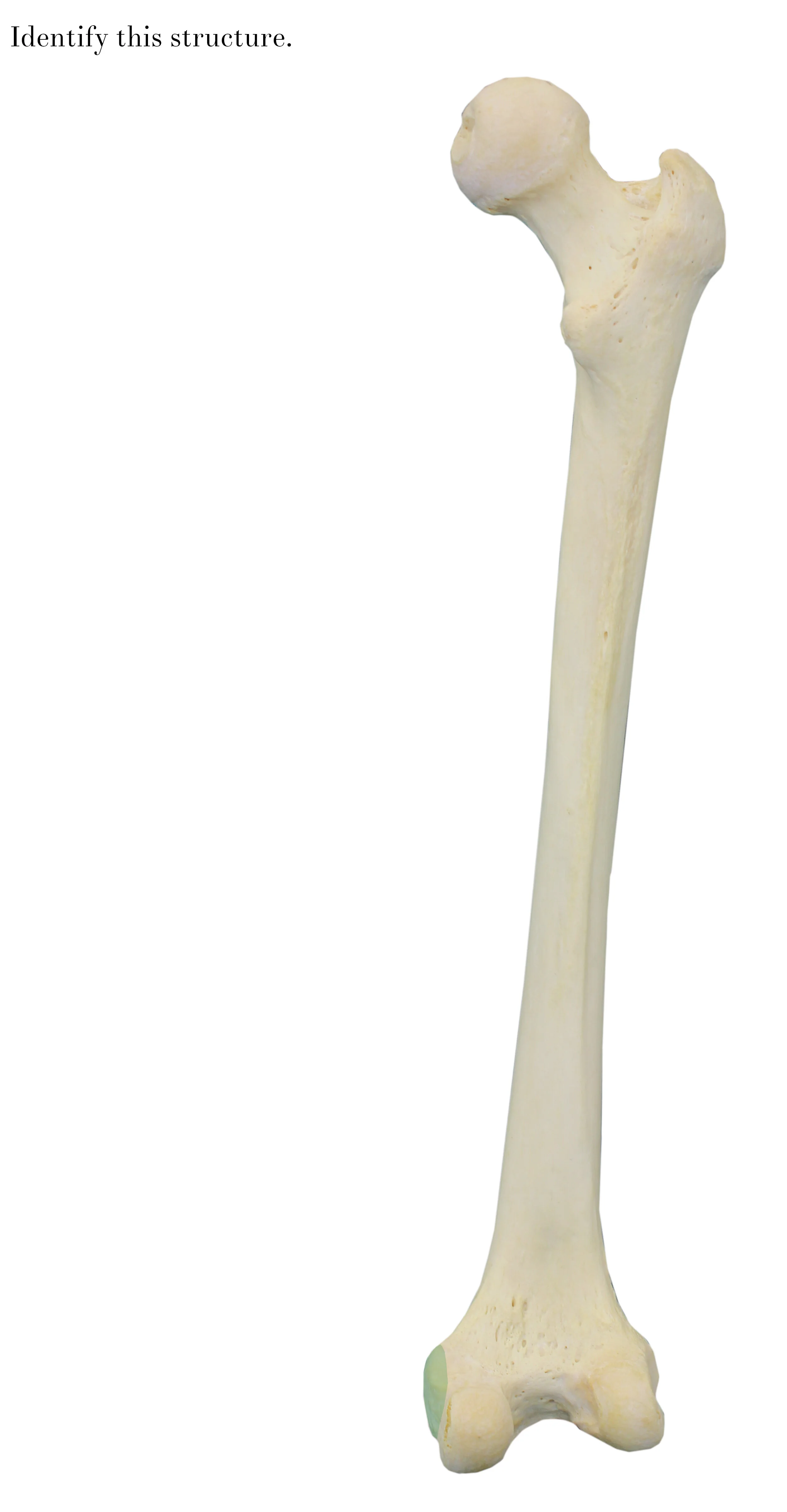 IMG_0642_medial_epicondyle_identify.jpg