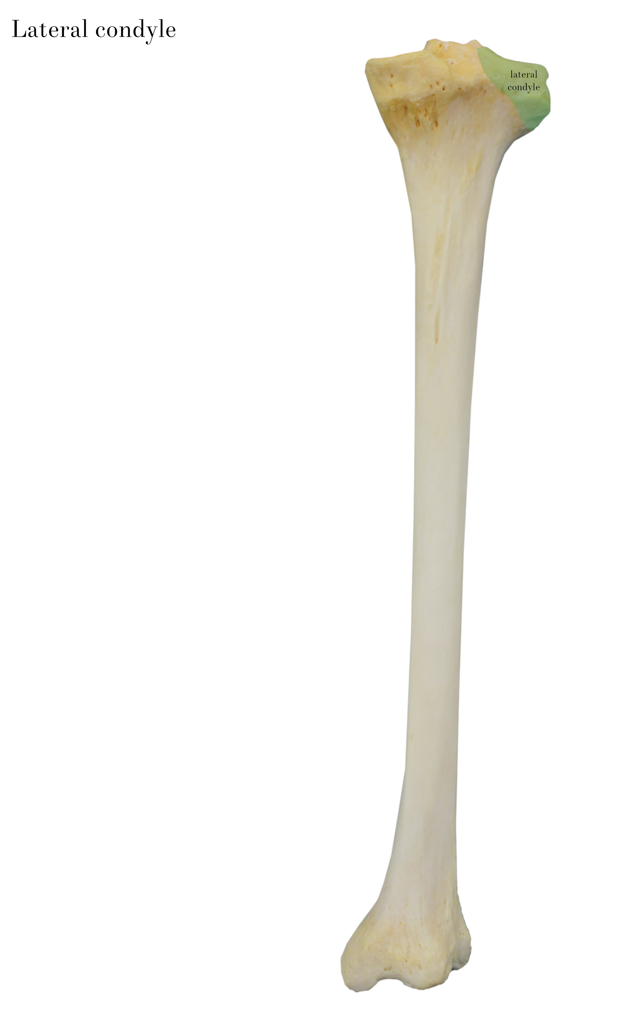 IMG_0644_lateral_condyle_labelled.jpg