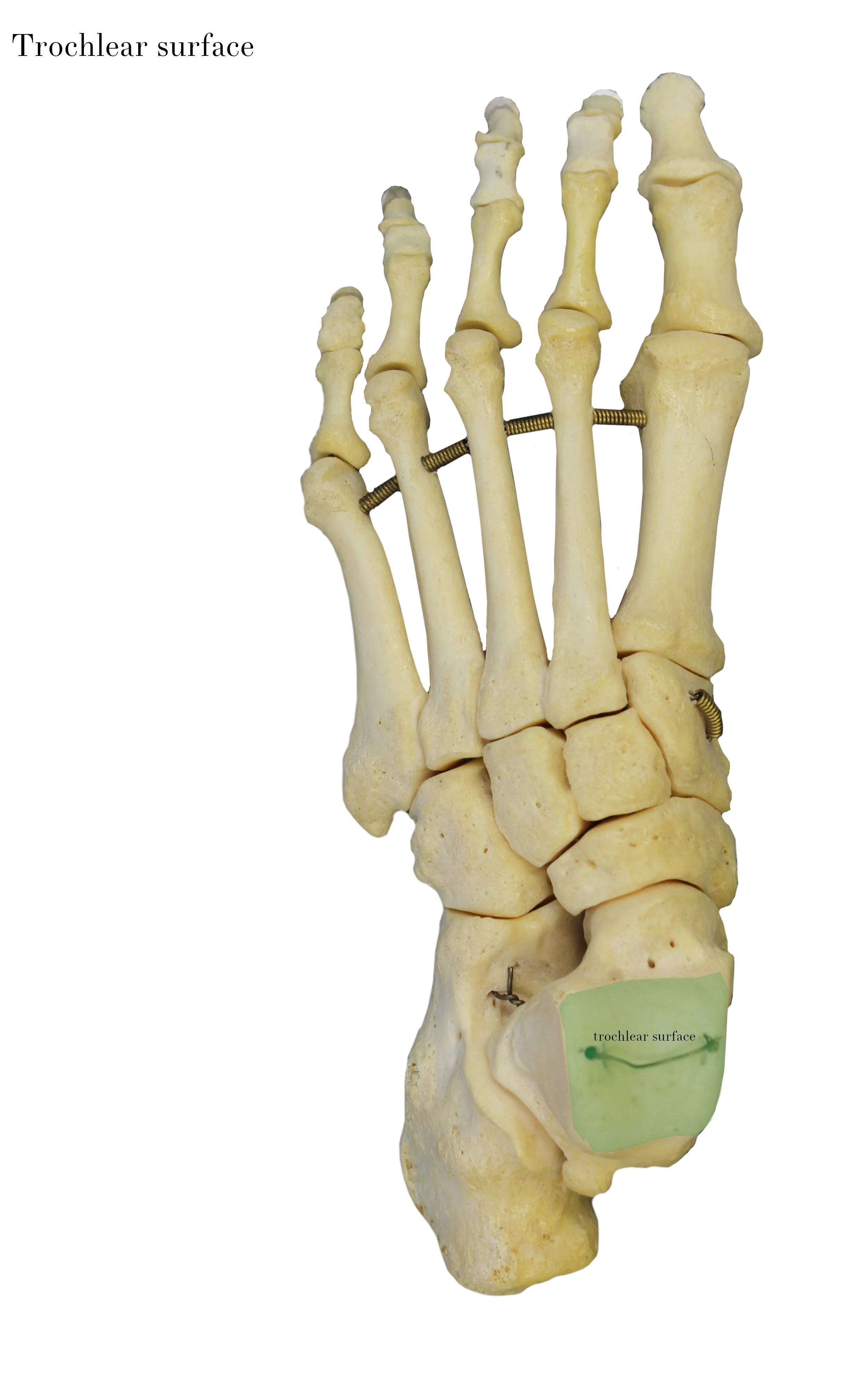 IMG_0650_trochlear_surface_labelled.jpg