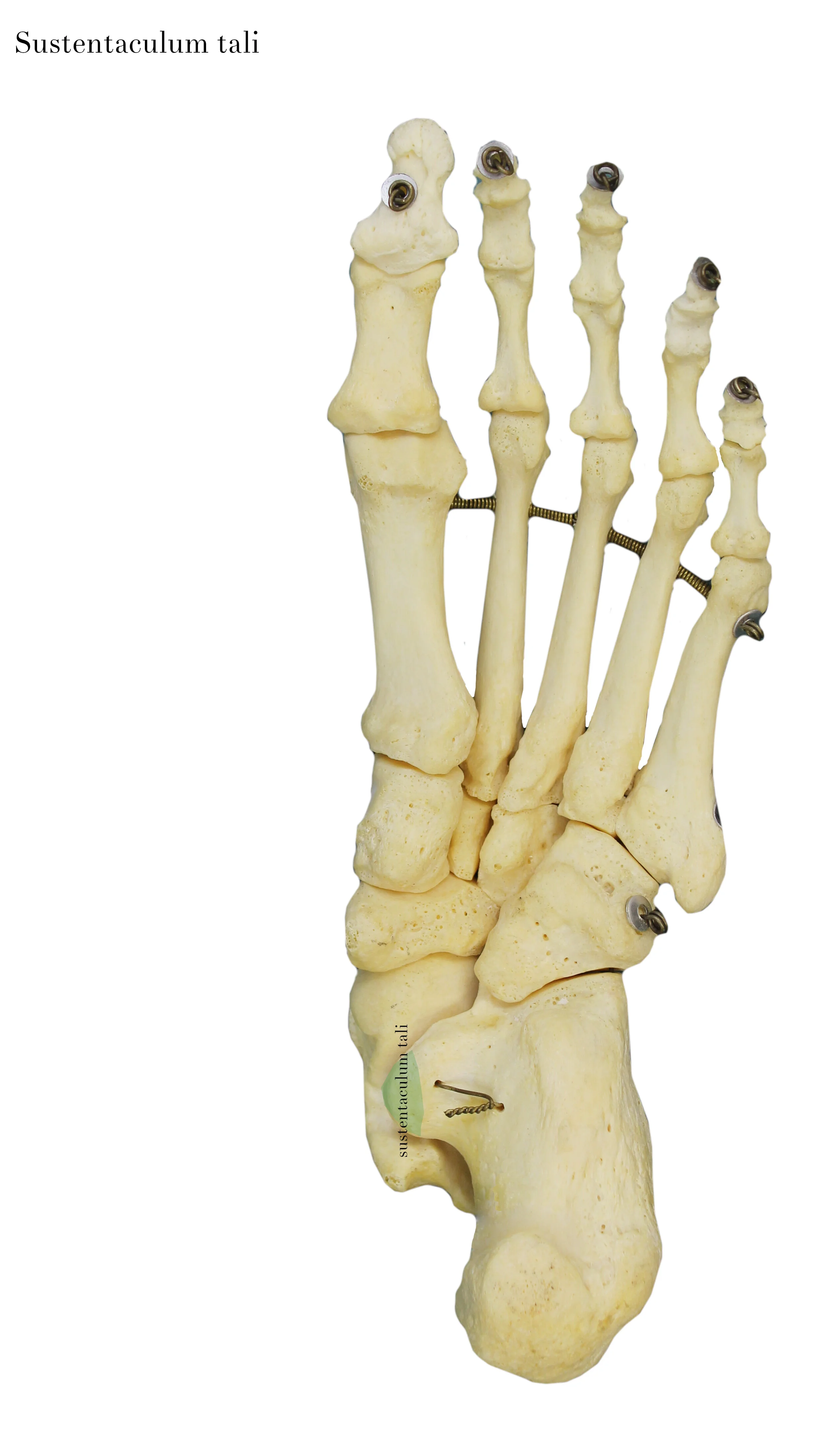 IMG_0651_sustentaculum_tali_labelled.jpg